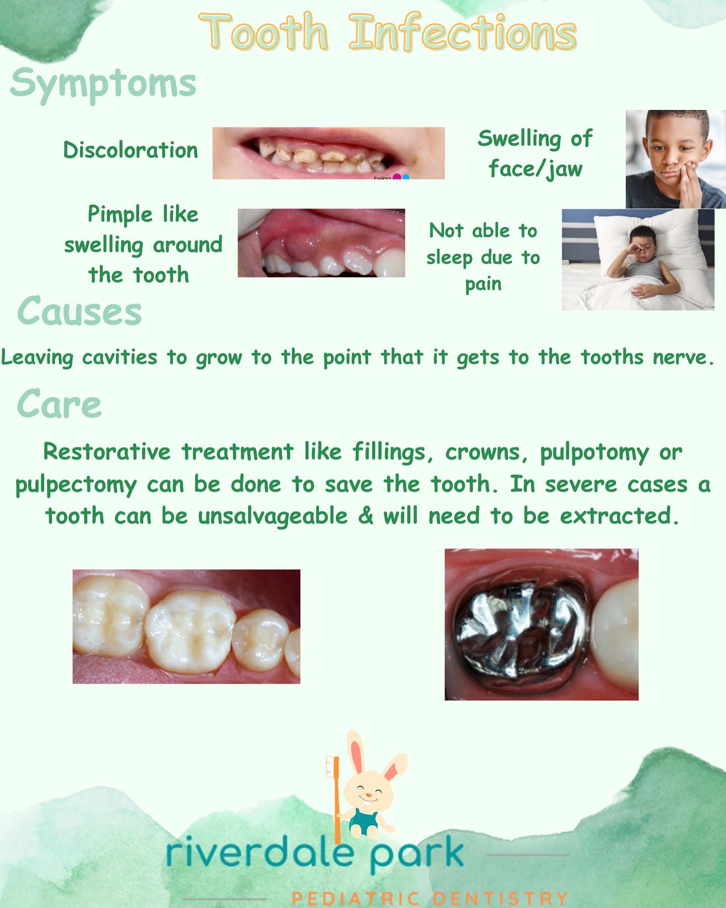 Tooth infections are common when having poor oral hygiene so make sure to brush & floss twice a day! ๐