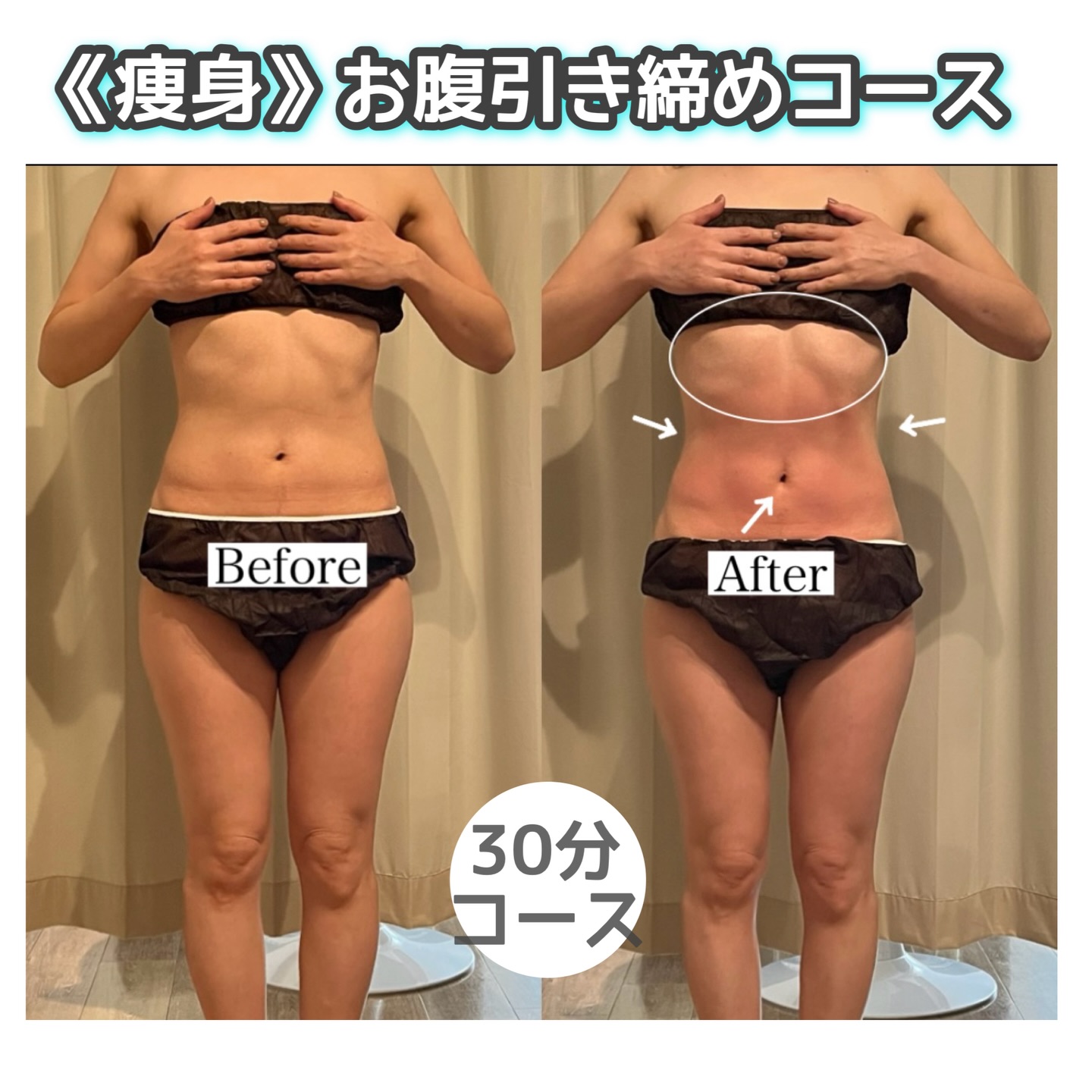 【痩身】時短‼︎お腹引き締めコース(30分)
お腹の輪郭がくっきりして、くびれもよりしっかり出ました✨
姿勢も良くなり、横から見ても変化が一目でわかります😳
キャビテーション×ラジオ波×痩身マッサージで
脂肪を乳化〜血行促進・分解促進〜もみほぐしまでたっぷり入ったコース❗️🔥
1回でも、むくみがとれて脂肪分解をしっかりしてくれます♪
プラスオプション💫
・ヒートマットで汗を出し、体の中の老廃物をしっかり排出
《デトックス ¥1,000(20分)》
・脂肪を減らすには必須※筋肉運動
《筋肉運動EMS ¥1,500(20分)》オススメ⭐️
より早く効果を出したい・運動が苦手・汗をかきにくい
そんな方は⬆️2つのオプションプラスしていただくと⭕️
気になる箇所を選べて集中的にケアができます!
オプションの有無は当日に決めても🆗
リーズナブルで通いやすい☆
高額なコース契約・勧誘は一切あ