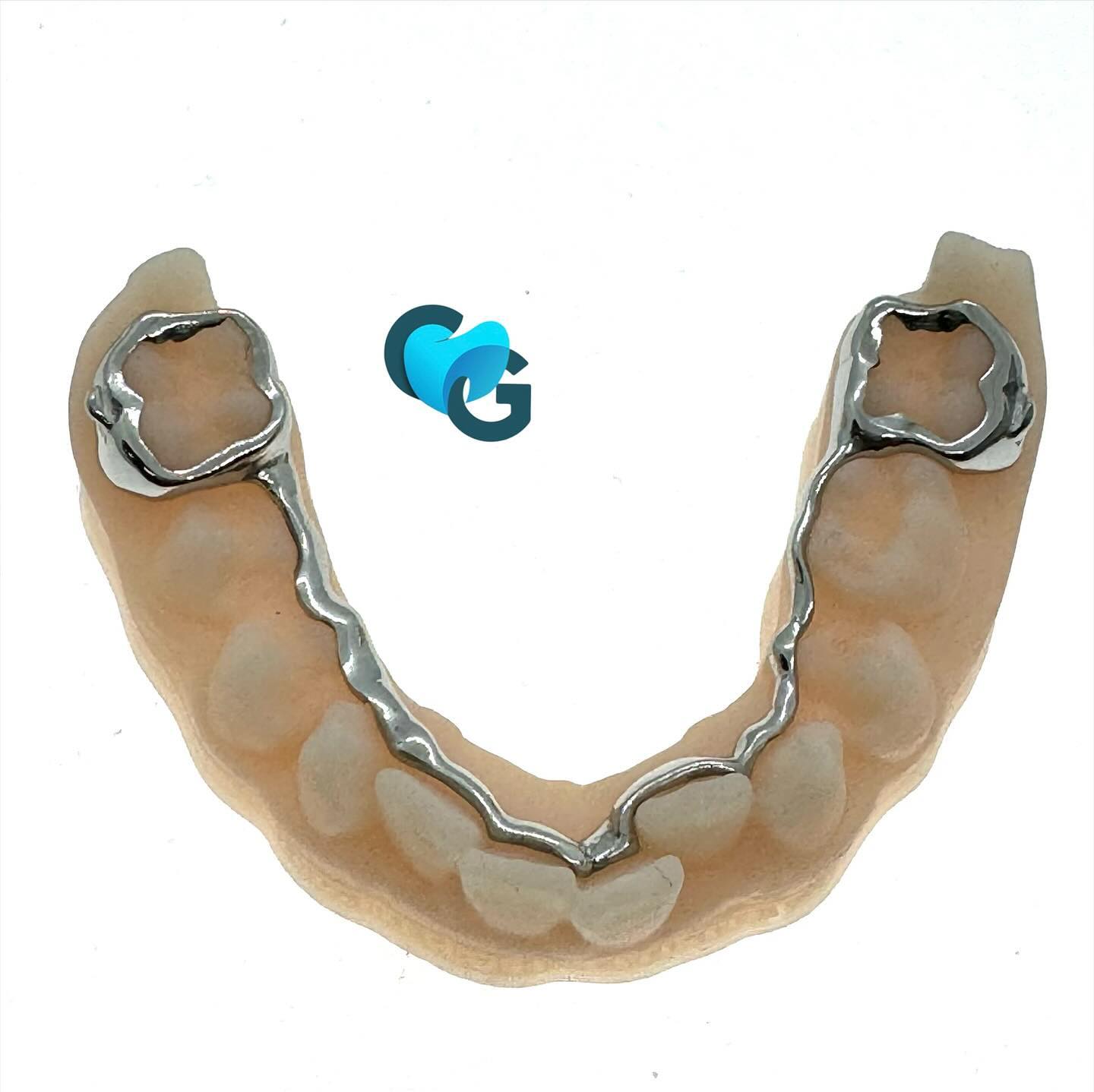 #arclingualanatomique #arclingual #ortho #dent #usinage #technique #croissance