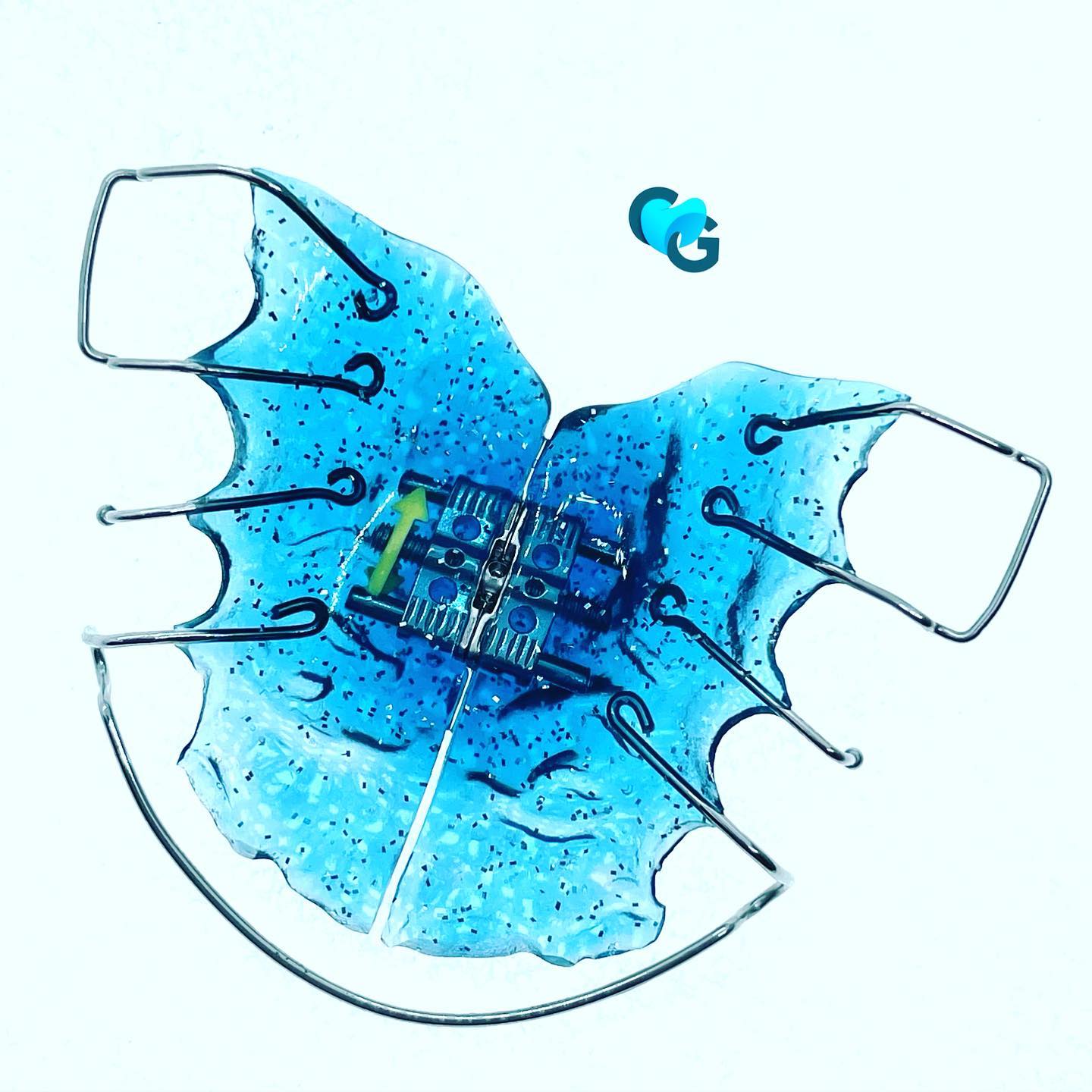 #orthodox #orthodontie #orthocolors #expansionpalatine #ortho #dentaltechnology #dental #dentalpassion