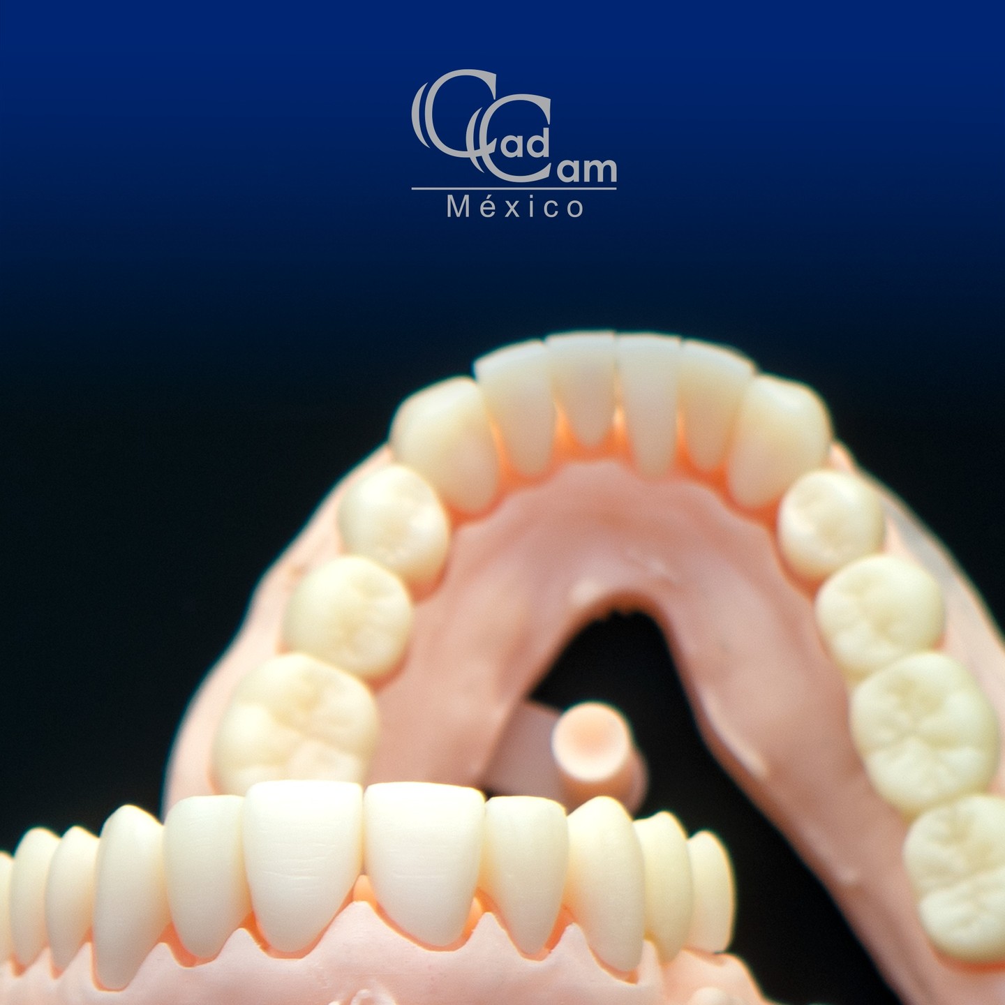 Para nosotros es muy importante probar en Px cada caso total antes de concluirlo, para rectificar DVO, tamaños y formas, y así lograr una gran satisfacción para el Px.
#CadCamMéxico #CadCam #DigitalWorkFlow #DigitalDesign #DigitalDentistry #EPSDentalLab #DentalLab #ThomasGraber