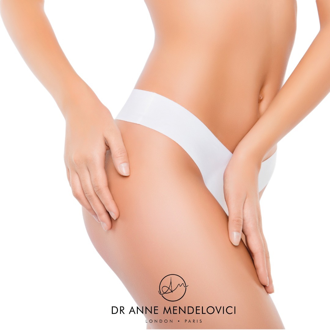 ULTRAFORMER III ✨
ULTRAFORMER III is the latest non-surgical technology using High-Intensity Focused Ultrasound (HIFU). It creates Micro and Macro Focused Ultrasound (MMFU) to deliver a non-invasive body lifting treatment and help reduce cellulite.
ULTRAFORMER III is built to target multiple depths of skin to get rid of stubborn fat near the hips or flanks. Without any downtime, the ULTRAFORMER III offers the solution to ensure maximum convenience and comfort followed by impressive results.
Rejuvenation - neck lift.
Re-tensioning - lifting and destruction of the fat on the inside of the arms.
Re-tensioning - lifting and destroying the fat of "love handles".
Re-tensioning - lifting and destruction of the abdomen fat (eg after pregnancy).
Re-tensioning - lifting and destruction of fat in the thighs, calves and ankles.
Re-tensioning - lifting the skin above the knee.
Email contact@drmendelovici to book your appointment 📩