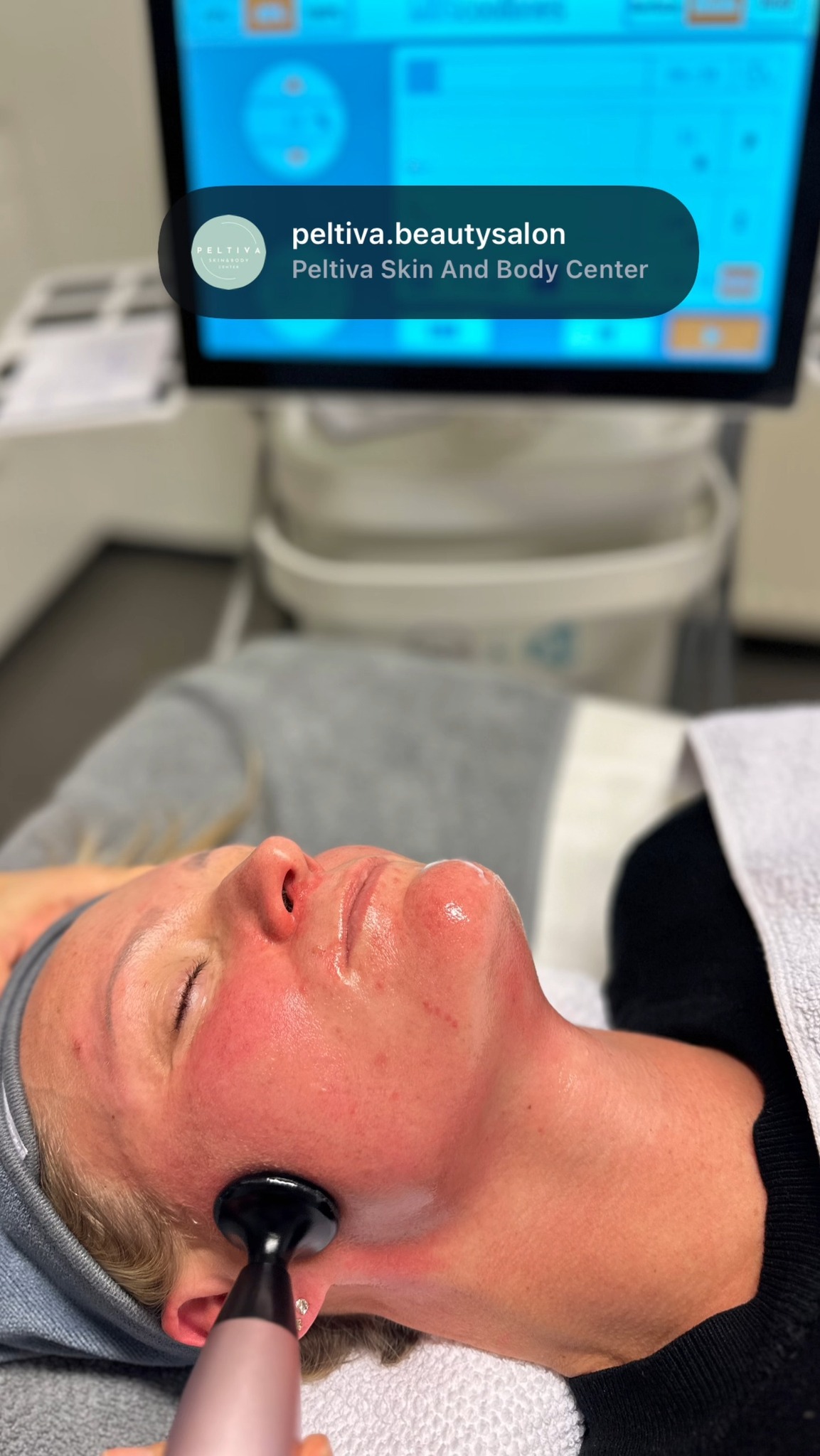 Targets: double chin, skin sagging, wrinkles, and dark circles under the eyes.
Contact us to learn more and enjoy the launch treatment price.