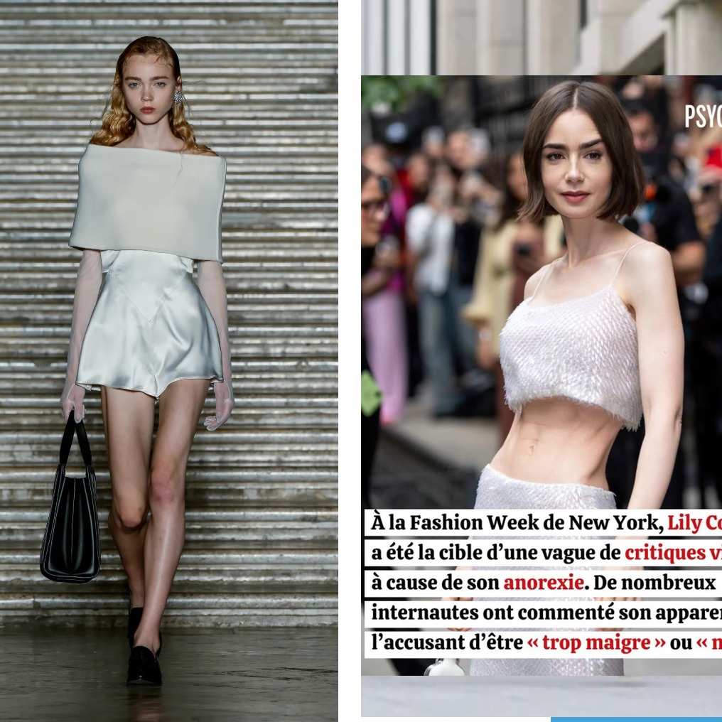 Je pensais que ça allait mieux du côté des mannequins pour exiger d'elles une taille 32-34 alors qu'elles mesurent plus d'1m75... Mais non!
Mélanie décrit un état d’euphorie trompeur. « Dès que tu ne manges pas, tu te sens hyper bien, tu te sens comme sous drogue. » Cette adrénaline masque la fatigue, la poussant à des extrêmes : 250 calories par jour (contre environ 2 000 kcal par jour pour une jeune femme) et du sport à outrance, parfois en pleine nuit.
Une maladie plus forte que tout
Avec recul, elle explique que la volonté ou l’affection des proches ne font pas le poids face à l’anorexie. « Même la culpabilisation par rapport à ma fille, ce n’était pas assez fort », avoue-t-elle. Elle compare sa maladie à une toxicomanie dure : « C’est comme une mère droguée qui met ses gamins en danger. L’addiction est tellement forte qu’il n’y a rien qui peut t’arrêter. » Le déclic ne pouvait pas venir de l’extérieur, ni de l’amour des siens. Il devait venir d’elle.
Si vous souffrez de cette maladie, faites-vous aider le plus vite possible!
Dites-moi en DM si vous connaissez une personne qui a besoin d'aide sur les troubles alimentaires.