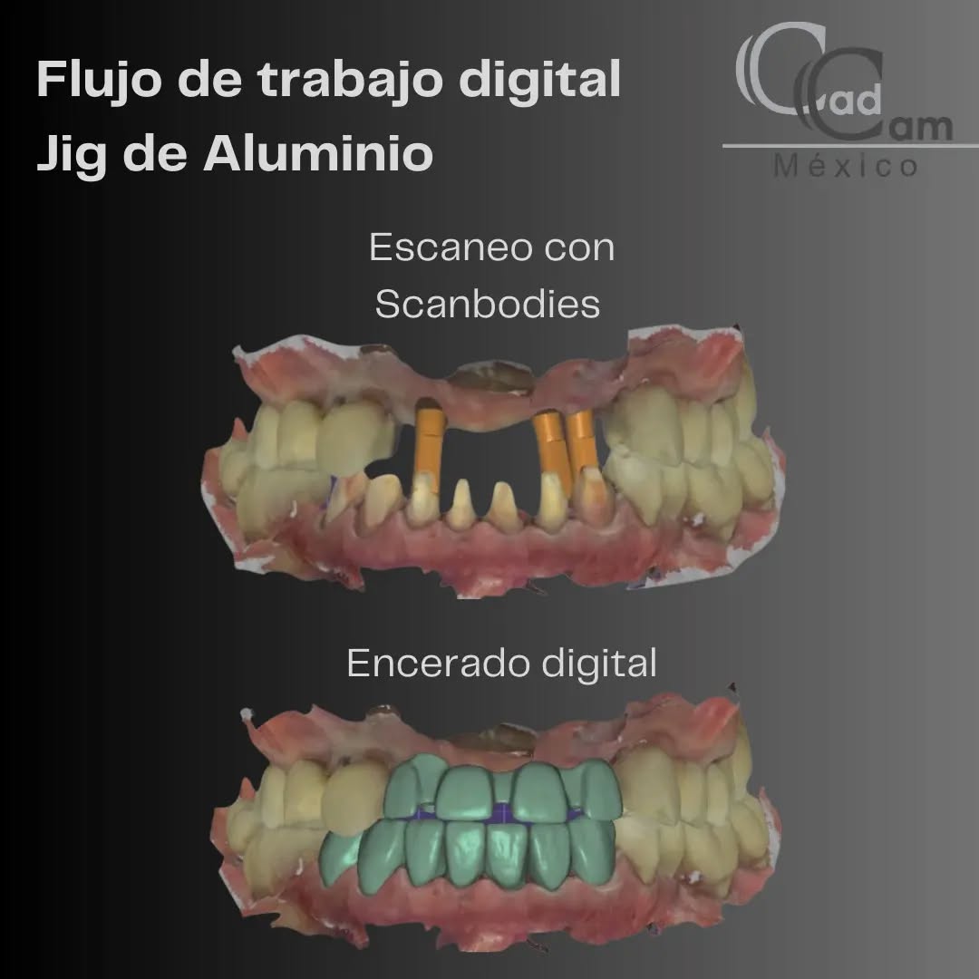 Realizamos escaneos digitales precisos con scanbodies, consíguelos en @implantshopmexico , uniendo la realidad con la digital para lograr un encerado digital impecable. Cada detalle cuenta, y nuestro compromiso con la excelencia se refleja en cada paso que damos. Desde el escaneo hasta el JIG de verificación final para asegurar asentamiento, cada proceso está infundido con innovación. Confía en Cad Cam Mexico para transformar tu práctica dental con precisión y tecnología de punta. - - - Aviso de responsabilidad: Todas las fotos publicadas en esta cuenta de Instagram son propiedad intelectual de Estudio de Porcelana Suizo S.A de C.V. y están protegidas por derechos de autor.pin alvaro obregon 134 cuernavaca #CadCam #Mexico #Cromocobalto #implantologia #implantesdentales #dentistry #dentista
