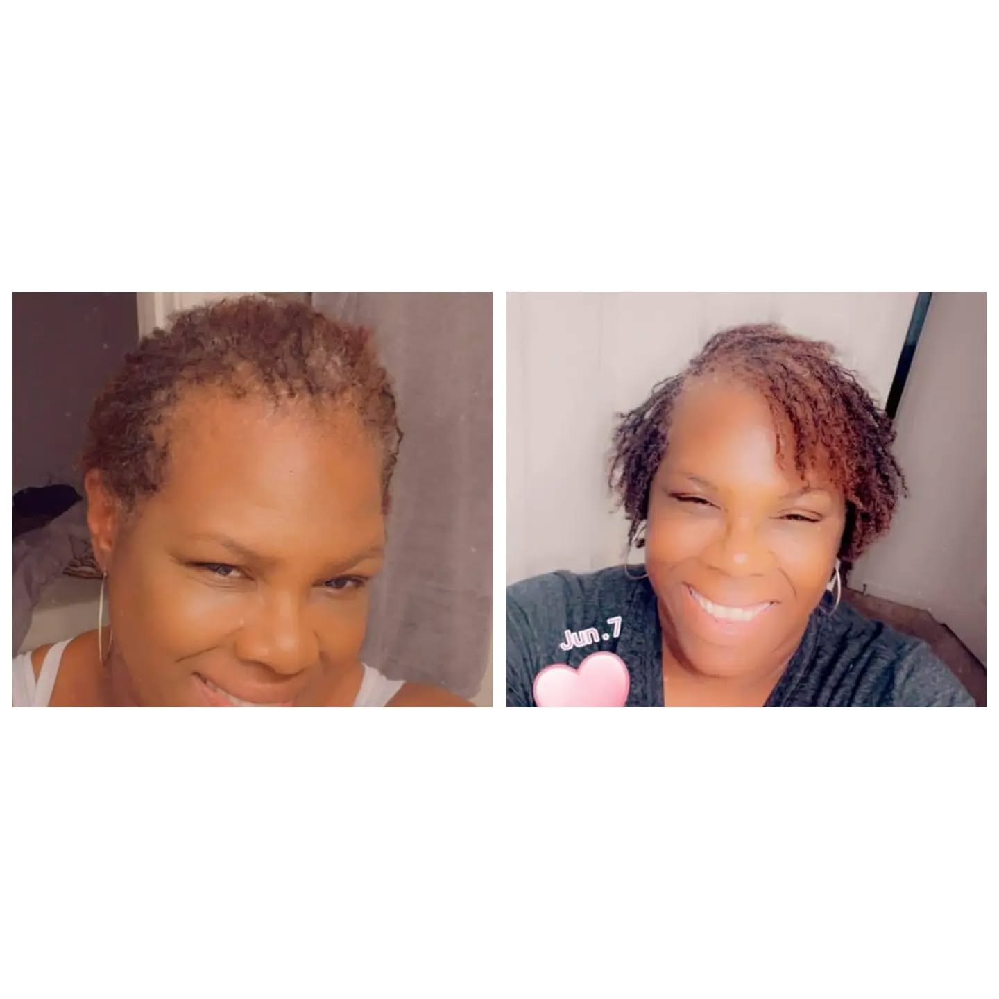 1 year anniversary #sisterlocks #greensboronaturalhair #gridlocdnaturalhair