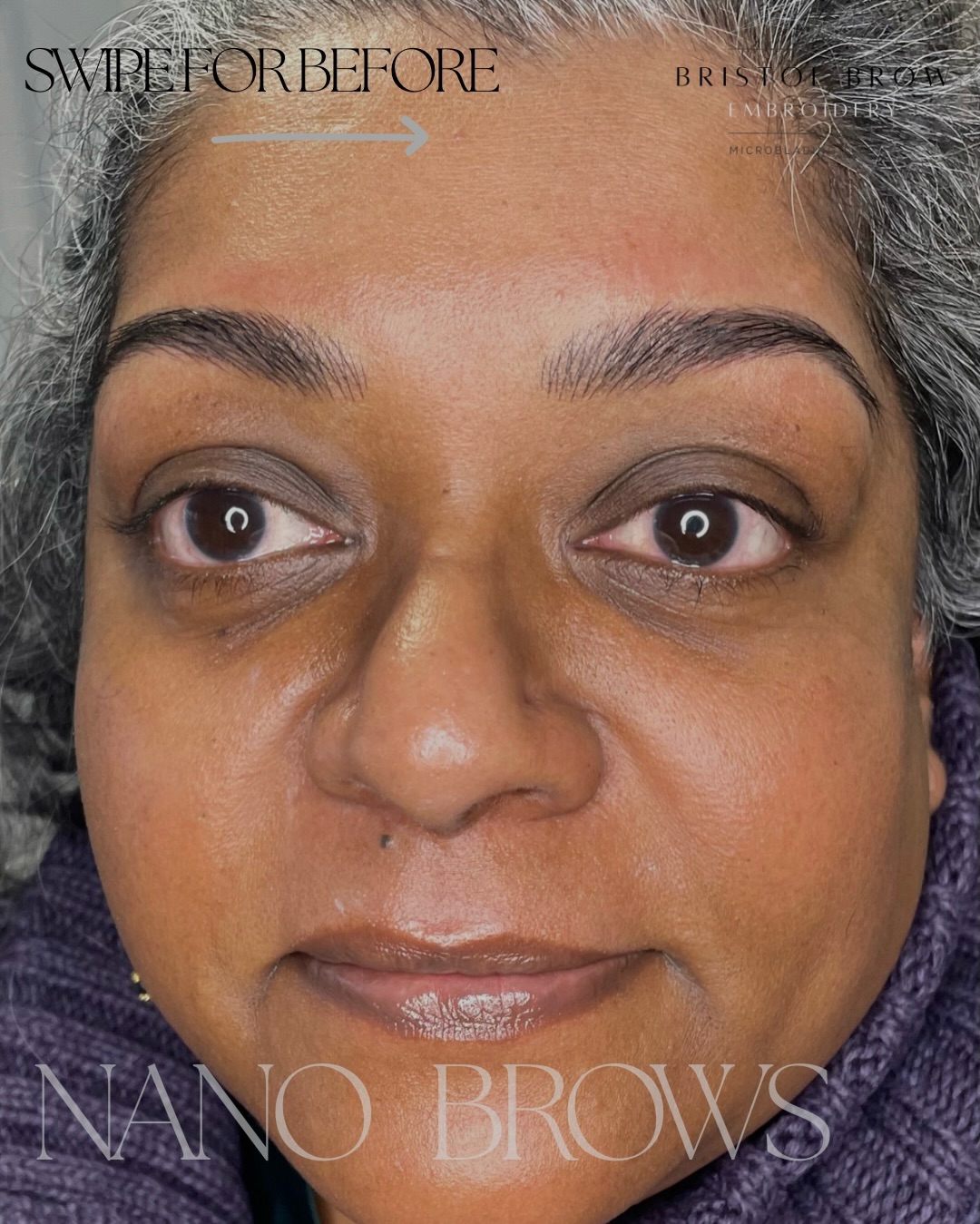 Swipe to see the transformation ✨
Subtle, natural nano brows designed to restore shape, balance, and fullness—without overpowering your features 💕
_________________________
🗓️ BOOK NOW - Link in Bio (this shows next Availability)
🌐 Further Information on Services & Prices at www.bristolbrowembroidery.co.uk
🏡 Home-Based Studio in Westbury-on-Trym, Bristol
⭐️ Five Star Google Reviews
💬 DM or Text 07920575556 with further enquires
_______________________
#PMUExpert #BristolBrowEmbroidery #MicrobladingArtist #SPMU #PermanentMakeupProfessional NaturalEnhancement BrowConfidence TrustedExpert ElevatedBeauty