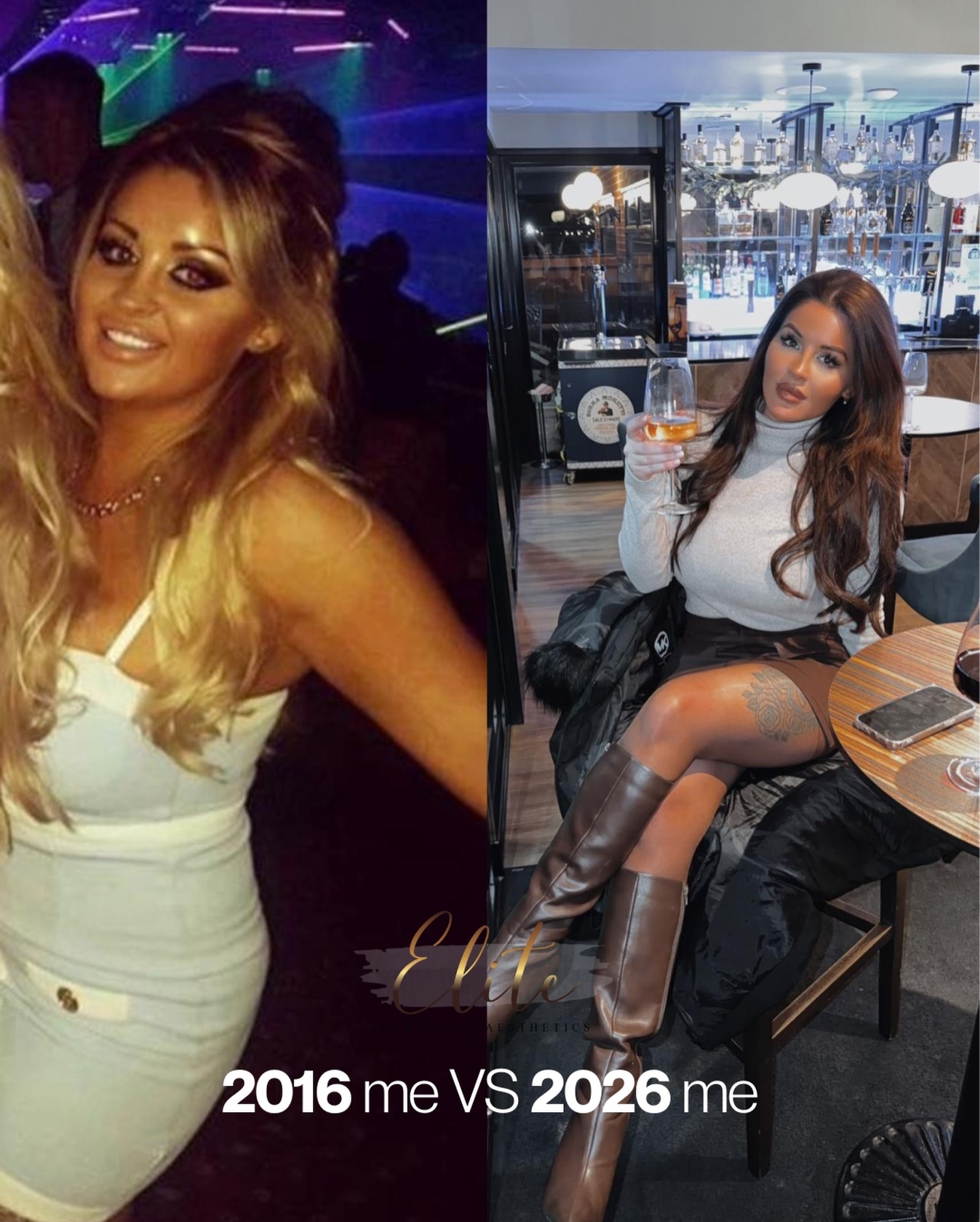 2016 me VS 2026 me … wow what a 10 years it’s been 👏🏼😜