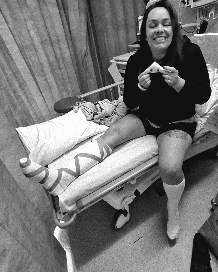 Life update from the Knots and Grains team 🤕
A clumsy moment has resulted in claire needing emergency surgery on her foot to repair a tendon. Looks like a cast for a while now. As it is just Alix and Claire in the workshop, this is going to make life a little more interesting 😂 As we do with everything life throws at us, we carry on and work alongside this bump in the road.
We will still be working on all orders and appreciate your patience with our replies ☺️
#knotsandgrains #clumsylife #smallbusiness #goldcoast #recycledwood #carryon