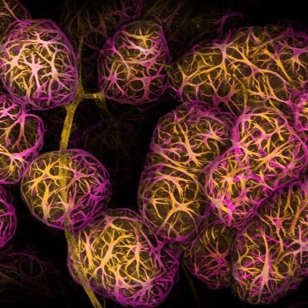 2nd Place Winner of the 2002 Google Nikon Microscopy: Breast tissue showing contractile myoepithelial cells wrapped around milk-producing alveoli. How beautiful is this!?