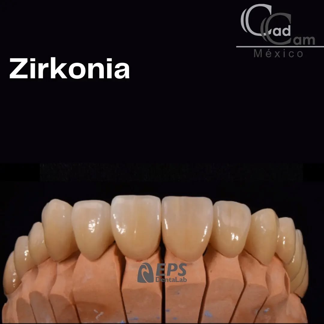 Carillas en Zirkonia Trabajo de Laboratorio @EPSLAB Se fabricó un arco completo de Zirconia, con un acabado natural haciendo énfasis en el alto grado estético y funcional.
-
-
-
-
-
Aviso de responsabilidad: Todas las fotos publicadas en esta cuenta de Instagram son propiedad intelectual de Estudio de Porcelana Suizo S.A de C.V. y están protegidas por derechos de autor. #CadCam #Mexico #Cromocobalto #implantologia #implantesdentales #dentistry #dentista
