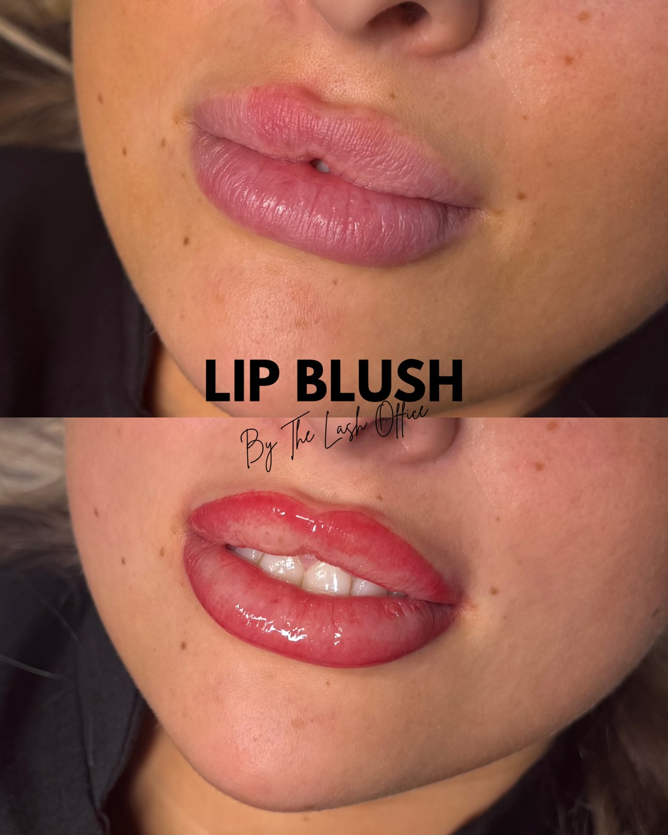 Ombre lip blush results✨ (liner focused)
How amazing is this before & after!
All lip blush is discounted to £100 till the end of March💸 (6 weeks top up is needed)
Pigments @killerbeautypmu
@brovi.uk Coco beans
@mara.colors Choco mauve
@permablend_pigments Pillow talk
📍 Bolton, Greater Manchester based.
#lipblushbolton #lipblushmanchester #ombrelipblush #lipblushtattoo lipblushing