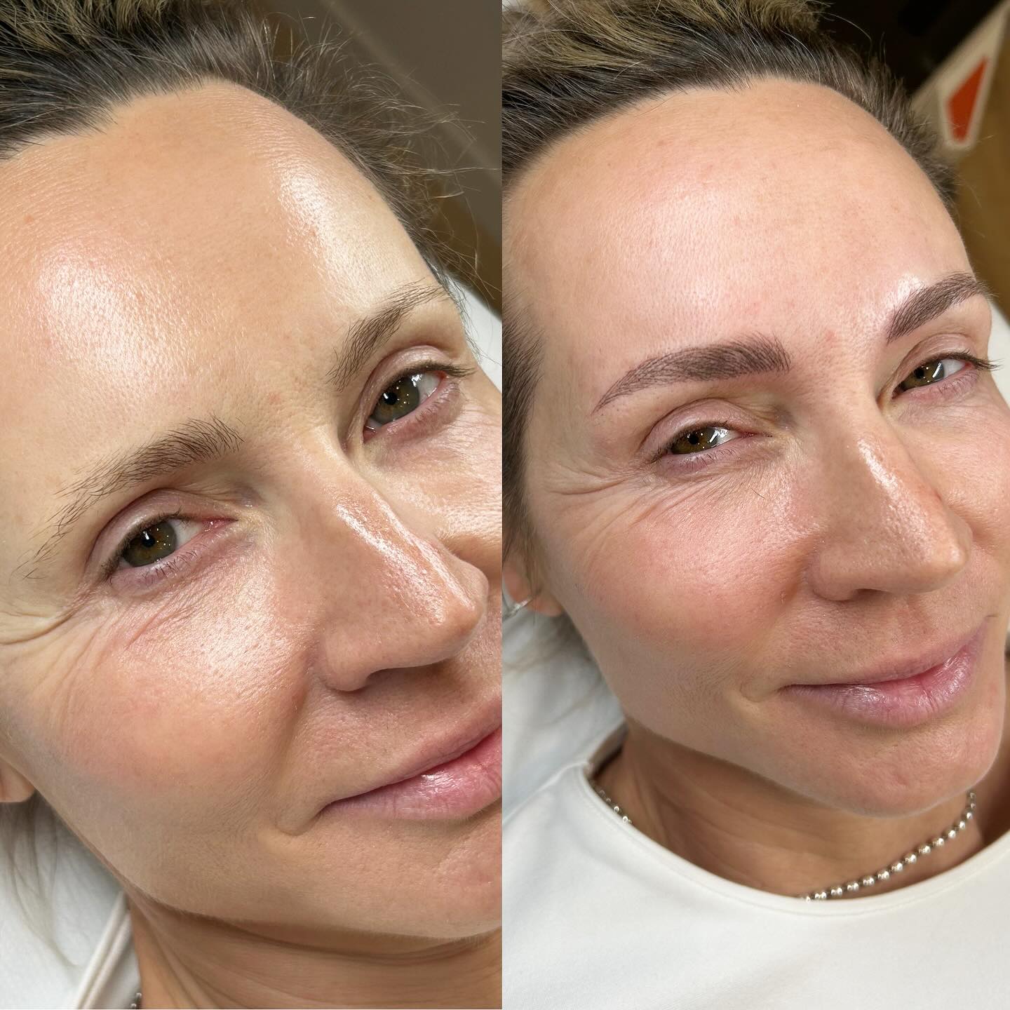 Before and after Microblading ✨
Natural & Beautiful results by Sofija