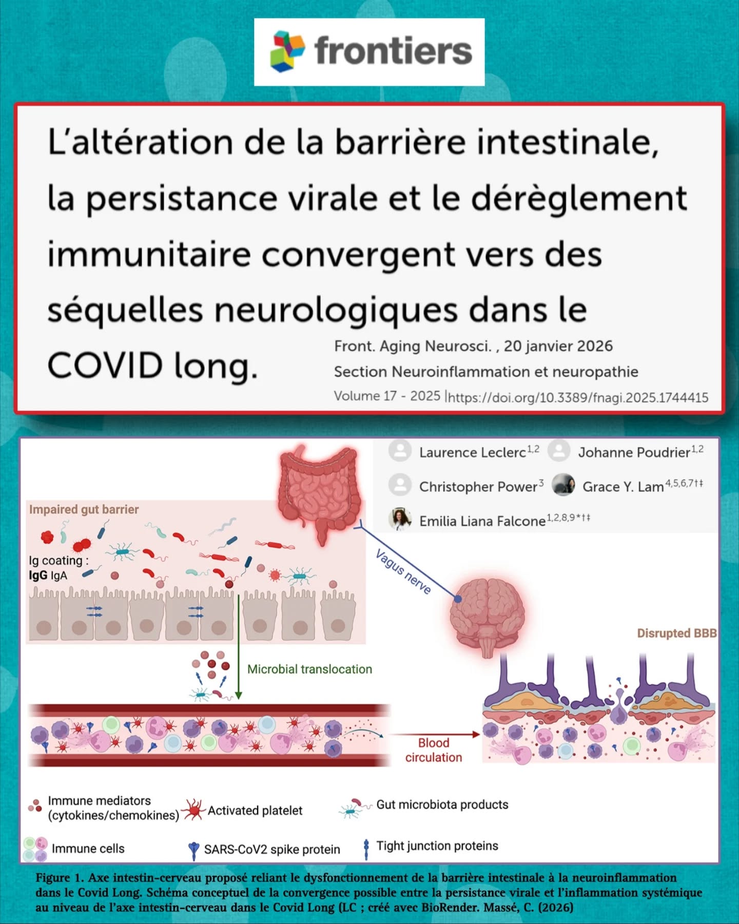 🧠🦠 #CovidLong : une nouvelle revue montre comment intestin, persistance virale et dérèglement immunitaire convergent vers des séquelles neurologiques durables.
Un modèle mécanistique cohérent émerge.
🧠Le #CovidLong n’est pas qu’une fatigue prolongée mais correspond à un syndrome multisystémique associant fréquemment :
➡️Fatigue intense
➡️Malaise post-effort #MPE
➡️Troubles cognitifs #brainfog
➡️Dysautonomie (POTS…), anxiété, dépression.
🦠1er pilier : la persistance virale.
Des fragments du #SARSCoV2 (protéine Spike, nucléocapside, ARN viral) sont détectés plusieurs mois, voire plus d’un an après l’infection, dans le sang et dans divers tissus.
🧬La protéine Spike persiste notamment dans les monocytes non classiques, ce qui entretient une activation immunitaire chronique, même en l’absence de réplication virale détectable.
🦠2ème pilier : l’atteinte intestinale.
Le SARS-CoV-2 infecte les entérocytes (forte expression d’ACE2), ce qui favorise une dysbiose et des lésions des jonctions serrées → augmentation de la perméabilité intestinale (« intestin perméable »).
🧫Conséquence directe : des produits bactériens et fongiques (LPS, β-glucanes, etc.) traversent la muqueuse et passent dans la circulation sanguine (translocation microbienne), ce qui entretient une inflammation systémique chronique.
🧪Le microbiote des patients Covid Long montre une :
⬆️Augmentation de bactéries pro-inflammatoires
⬇️Diminution des bactéries productrices de butyrate (anti-inflammatoire)
→ perte de régulation immunitaire au niveau intestinal et systémique.
🔥3ème pilier : le dérèglement immunitaire.
On observe des taux élevés de cytokines pro-inflammatoires (IL-6, TNF-α, IL-1β…), une activation des monocytes, une hyperactivité des neutrophiles avec formation de NETs, et la présence d’auto-anticorps chez certains patients.
🩸Ces mécanismes favorisent :
🩸la formation de micro-caillots
🧬l’inflammation endothéliale
🫁l’hypoperfusion tissulaire
Cela contribuant à un cercle vicieux inflammatoire et vasculaire.
⏬Suite en commentaire⏬