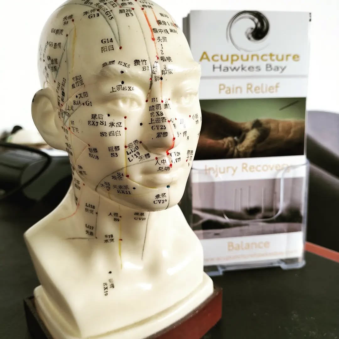 Did you know that acupuncture is used for migraines, hay fever, anxiety, insomnia and I've even treated people for Anosmia (loss of smell sense)
#acupuncturenz #acupuncturehawkesbay #plusrehab #acupuncture
#waipukurau