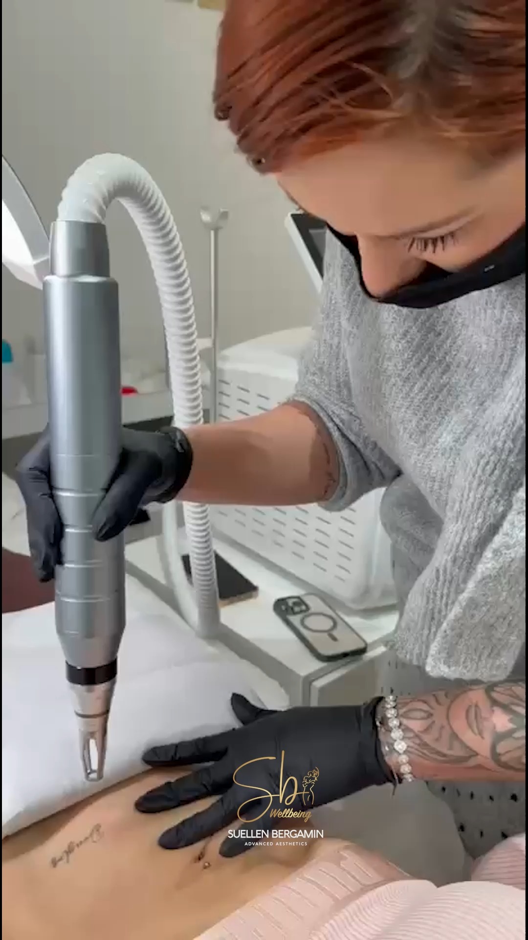 Se arrependeu da tatuagem, enjoou do desenho ou quer renovar o espaço para um novo?
A remoção de tatuagem a laser é um dos procedimentos mais procurados da estética atual.
O laser age quebrando o pigmento da tinta, permitindo que o corpo elimine aos poucos, de forma segura e eficaz.
O tratamento pode clarear ou remover a tattoo, preservando a saúde da pele e possibilitando um novo começo.
Agende seu horário e vamos conversar. ☺️
📲+44 7398 192413
.
Have you regretted a tattoo, grown tired of the design, or want to free up space for a new one?
Laser tattoo removal is one of the most sought-after aesthetic treatments today.
The laser works by breaking down the ink pigment, allowing the body to gradually eliminate it in a safe and effective way.
The treatment can lighten or remove the tattoo, preserving skin health and making room for a fresh start.
Book your appointment and let’s talk. ☺️
📲 +44 7398 192413