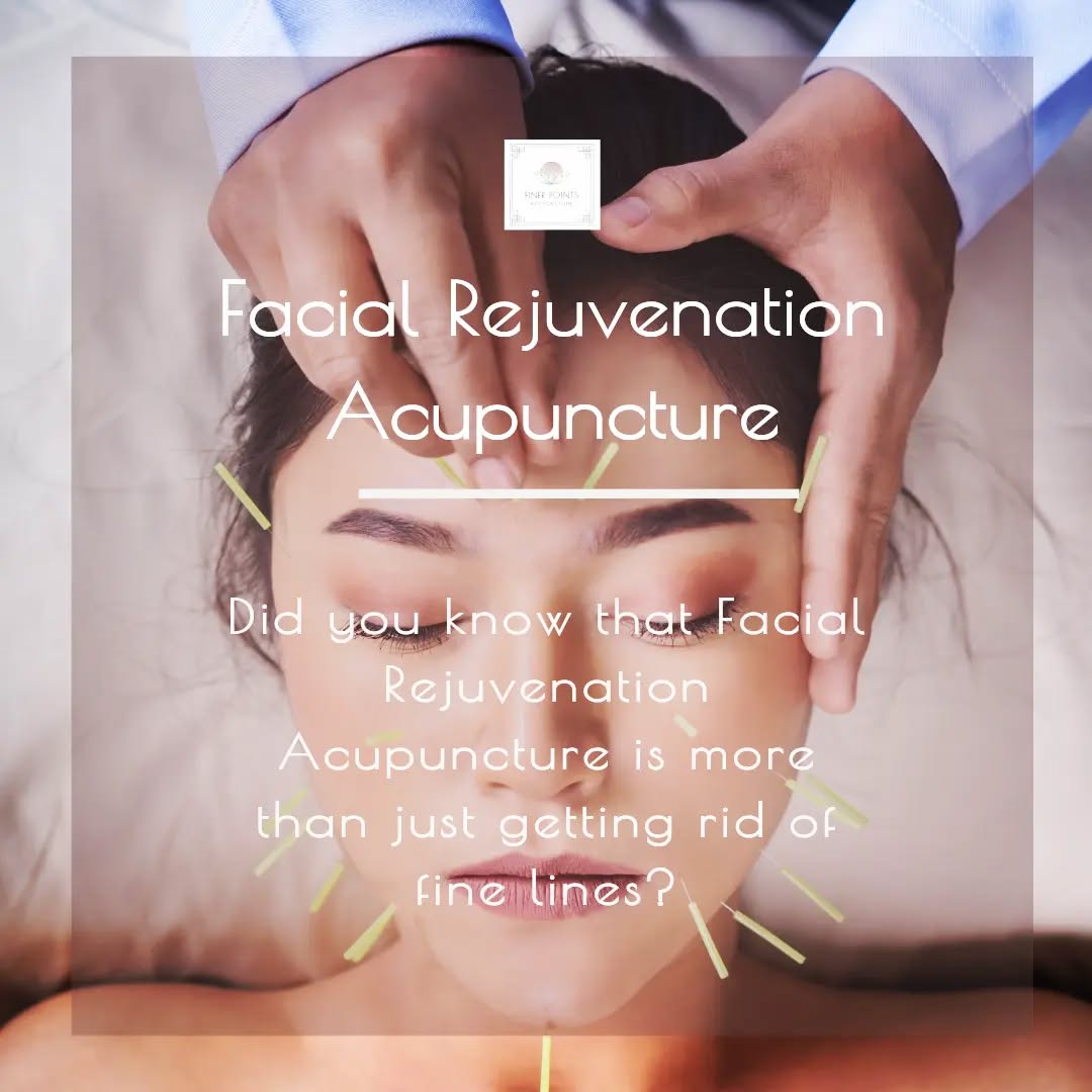 Ever thought of getting Facial Rejuvenation Acupuncture but wasn’t sure what other benefits you could have other than getting rid of your fine lines?
Facial Rejuvenation Acupuncture has so much more benefits!
It lifts and firms sagging skin, decrease puffiness around your eyes, reduces the depth of deep wrinkles, erases fine lines, increases the radiance of your complexion and skin in sunken areas of your face, and builds collagen to improve the texture of your skin.
And did you know that that Facial Rejuvenation Acupuncture is not merely cosmetic but we also work on you internally so that you are feeling great inside and out?
So, not only do you get the benefits of looking great but you also feel great on the inside.
#finerpointsacupuncture #chinesemedicine #TCM #facialrejuvenationacupuncture #acupuncture #holisticmedicine #beauty