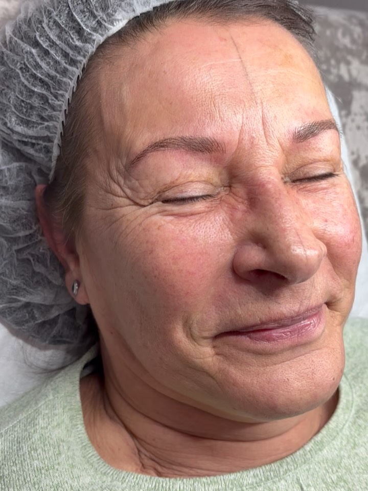 ✨ Eine glückliche Kundin ✨
Manchmal braucht es gar nicht viel – eine harmonische Form, eine natürliche Farbe und ganz viel Feingefühl.
Das Ergebnis: ein frischer Blick, mehr Ausdruck und ein Lächeln, das von Herzen kommt 🥰
Danke für dein Vertrauen 🤍
Ich liebe es, natürliche Schönheit sanft zu unterstreichen
#salonjuna #pmuaugenbrauen #natürlicheaugenbrauen #reifehaut #microbladingallgäu #combobrows #augenbrauenliebe #kosmetikerinallgäu #pmuallgäu #beautyallgäu #wangimallgäu #vorhernachher #sanfteschönheit #zeitlosschön