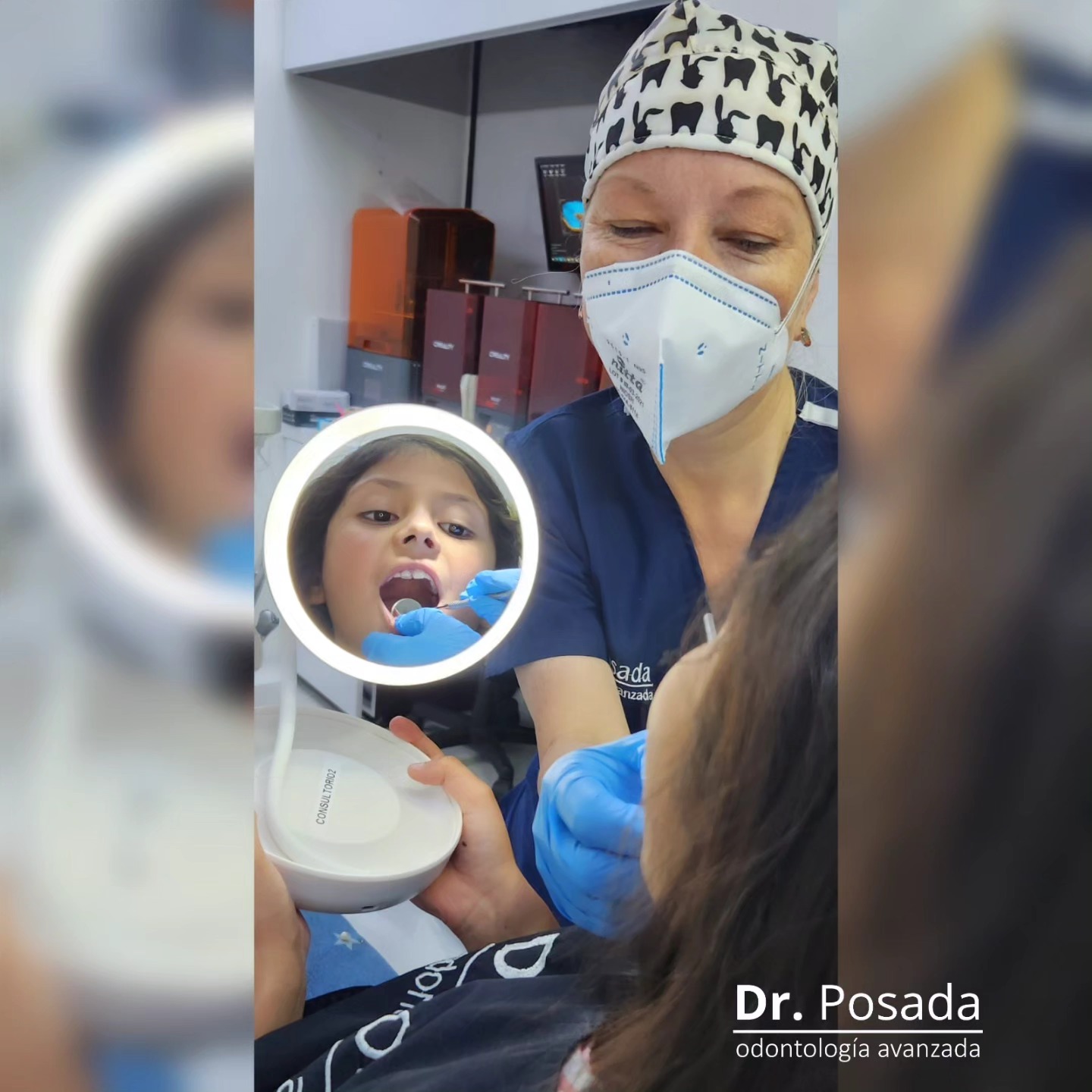 A veces los #dientesdeleche no se caen en el tiempo en que deberían hacerlo, una #valoraciondental temprana y un #tratamientoodontologico oportuno puede evitar problemas e intervenciones mas complejas en el futuro. Las sonrisas hermosas, empiezan con el cuidado desde niños.
.
.
.
📲304 6529022
📞 6017552046
.
.
#odontopediatra
#odontopediatria
#ortopediamaxilar
#ortodonciaenniños
#niñossanos