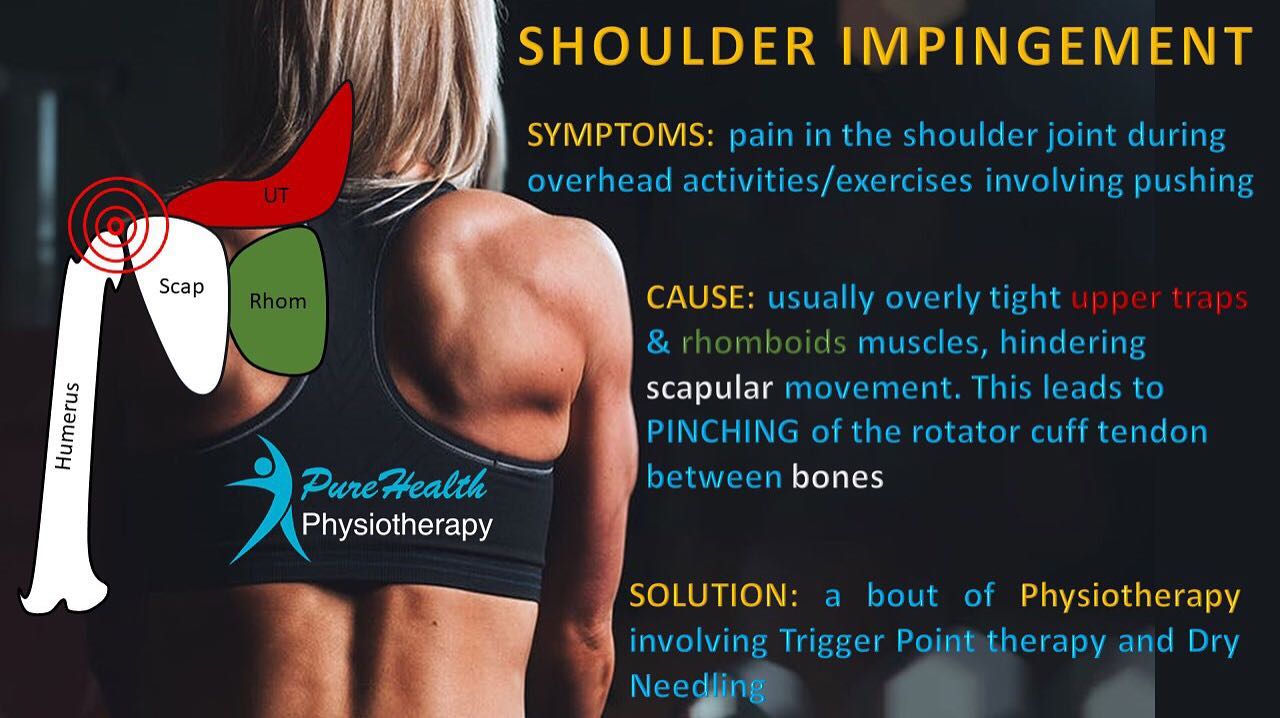 Shoulder pain is usually a matter of faulty biomechanics which can be easily corrected.
Contact us today:
www.purehealthphysio.co.uk
Info@purehealthphysio.co.uk
01784 421 218
07443419973
#physiotherapy #sportsrehab #sportsmassage #acupuncture #dryneedling #feltham #sunbury