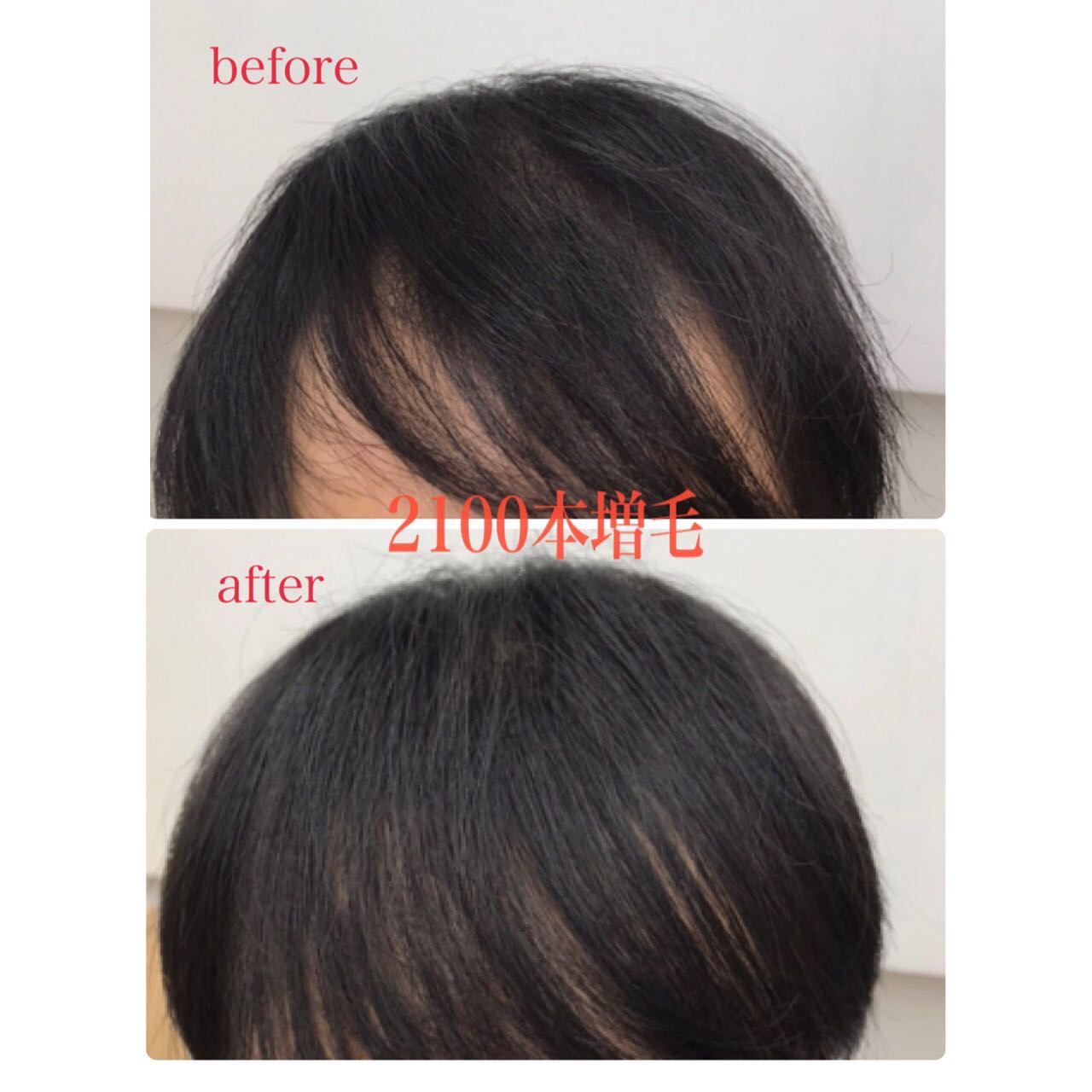 スポーツの秋、読書の秋、おしゃれの秋ということで皆様いかがお過ごしでしょうか?🍁
ご新規様、近日中に結婚式を挙げるとのことで気合いを入れて増毛頑張ってみました☺️
すごく増えましたよね、時間にして2.5h程でした👍
施術中も初めてお会いした方??と思うくらい会話も盛り上がりすごく楽しく過ごせました😊
改めまして、ご結婚おめでとうございます🎊
コロナ禍で大変だったと思います。
これからは沢山の幸せに溢れていくことでしょう😌
また、お気軽にお越し下さいませ✂︎
#センタリング
#センタリング神戸
#神戸 増毛
#三宮 増毛
#完全予約
#オーダーメイドかつら
#マンツーマンサロン
#完全個室
#おしゃれ増毛
#神戸元町
#メンズサロン