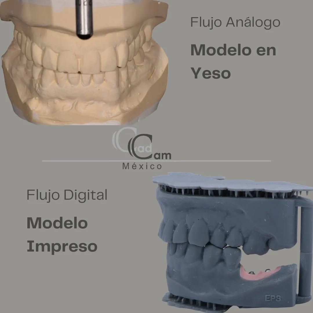 En la tradición de la odontología, los modelos análogos en yeso han sido una herramienta fundamental. Estos modelos físicos ofrecen una representación tridimensional de la boca del paciente, brindando a los profesionales una base tangible para sus procedimientos. En @EstudiodePorcelanaSuizo , utilizando tecnología de CAD CAM México, transformamos datos digitales precisos en modelos físicos con detalles asombrosos. La impresión 3D permite una personalización sin límites, facilitando la reproducción exacta de la anatomía dental del paciente. Esto no solo agiliza el proceso, sino que también abre la puerta a una precisión inigualable.
En Cad Cam México, nos enorgullece ofrecer un flujo de trabajo digital excepcional. Desde la captura de datos hasta la creación de modelos impresos de alta calidad, cada paso se realiza con precisión milimétrica. Esto no solo ahorra tiempo, sino que también mejora la calidad de los resultados, permitiendo a los profesionales brindar un cuidado dental de vanguardia. - - - Aviso de responsabilidad: Todas las fotos publicadas en esta cuenta de Instagram son propiedad intelectual de Estudio de Porcelana Suizo S.A de C.V. y están protegidas por derechos de autor. #CadCam #Mexico #Cromocobalto #implantologia #implantesdentales #dentistry #dentista