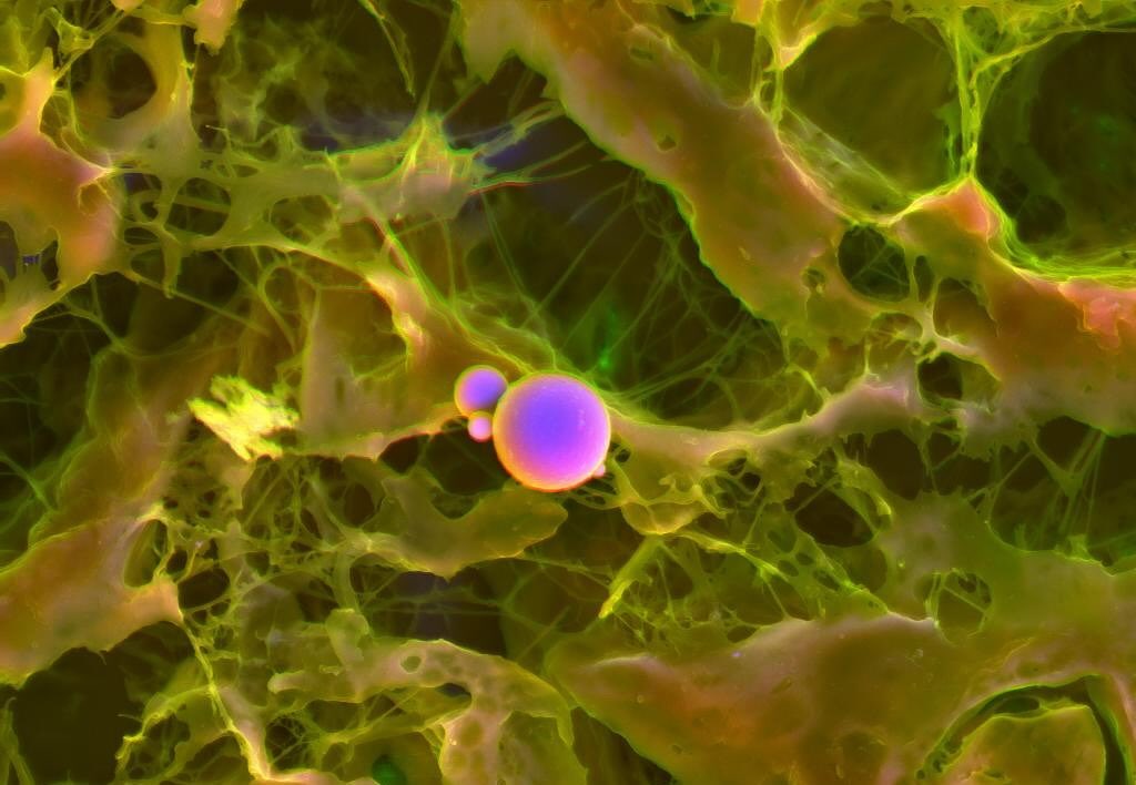 Cardiac calcification #science #electronmicroscope #laboratory #scienceart #sciencephoto #scientific #scienceweek #research #lab #micro #microscope #microscopy #medicine #medicalsciencestudent #medicalstudent #macrophotography #mineralomics #bio #biology #bioimaging #biologylab #minerals #chemistry #material #engineering #physics #sciencecommunication #ucl #DDCSEM #Mineralomics