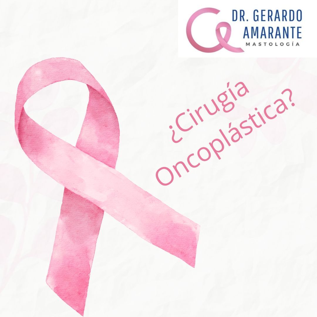 Con la adición de técnicas de cirugía plástica se pueden lograr resultados oncológicos excelentes preservando y en algunas ocasiones incluso mejorando la estética.
🥼 Dr. Gerardo Amarante
📍Centro de Cáncer de Mama Hospital Zambrano Hellion
📍GAMA Medicina de Alta Especialidad Col. Obispado
📍Hospitaria Hospital
☎️ Citas y Whatsapp 8115552813
#mastologo #cirugiademama #cancerdemama #mastologia #cancer #mastectomia #reconstrucciondemama #cirujanoespecialistaenmama #biopsiademama #oncologia #consultademama #cirugiaoncoplastica #octubrerosa #segundaopinion