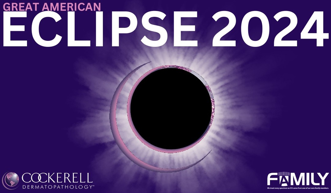 The clouds are clearing in Dallas! The total eclipse begins at 1:40 PM.
#dakprescott says, "HERE WE GO!"