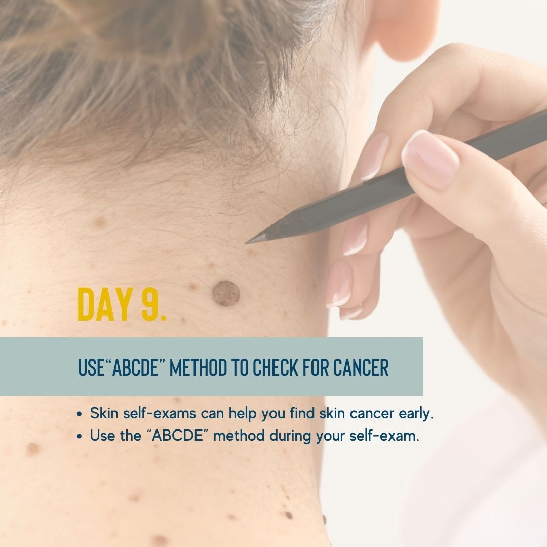 Skin self-exams can help you find skin cancer early.
Use the “ABCDE” method when conducting your self-exam and monitoring any moles you have. Check for changes in the asymmetry, border, color, diameter and if your mole is evolving.
If you notice a spot that differs from the others, or one that changes, itches, or bleeds, make an appointment to see a dermatologist.
#skincancerawareness #loveyourskinchallenge #healthyskin #nycesthetician #brooklynesthetician #nycacneexpert #antiaging #sunscreen