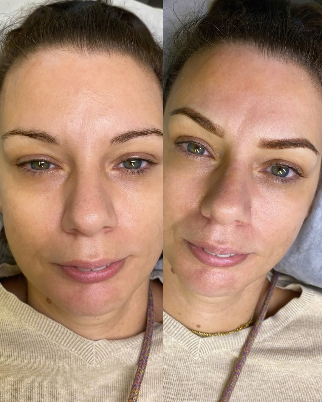 Do you have full brows but still feel the need to shape and fill them in every day? Power Brows is for you. 💕
My client wanted a soft, subtle, and natural result that enhances her shape while matching her skin tone and hair perfectly. Effortless beauty, every morning. ✨
Ready to simplify your routine? Book your appointment through the link in my bio.👩💻
#pmu #permanentmakeup #spmucardiff #powderbrows #cardiffbrows