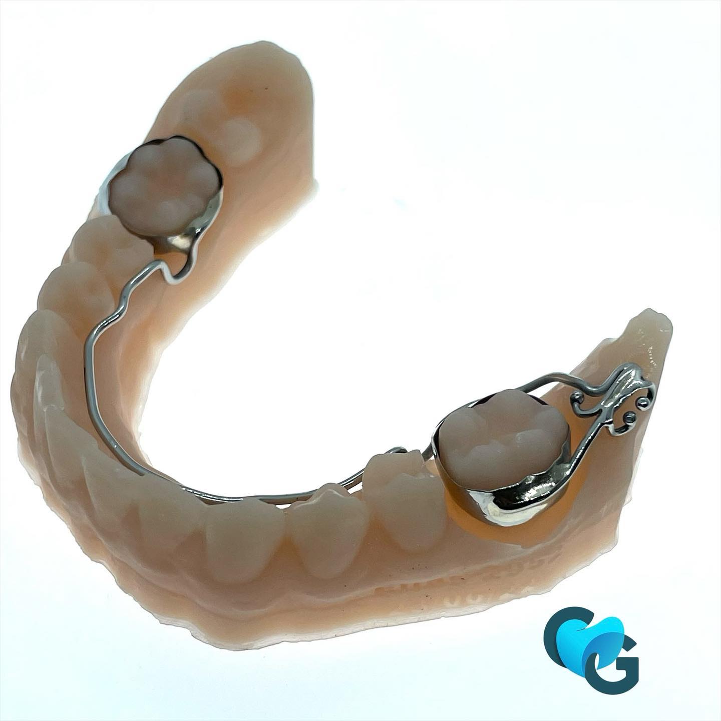 Arc lingual pour traction 37 #arclingual #ortho #orthodontielinguale #labodentaire #techniquedentaire #orthopassion #contention #dentaire #dent #37 #dentition