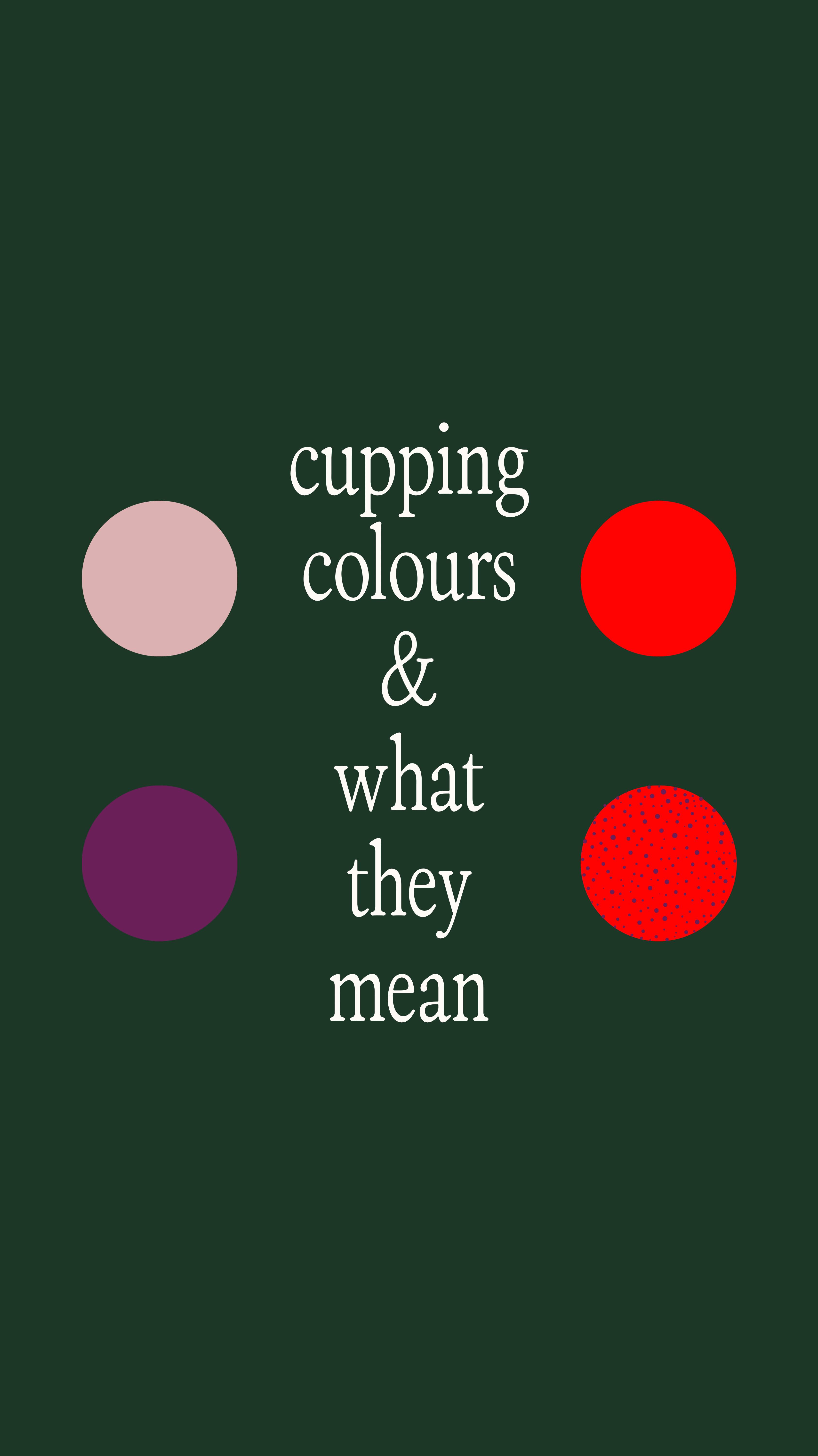 Cupping marks aren’t “bruises”, they are so much more, and we use them diagnostically!
In Traditional Chinese Medicine, the colour (or lack of colour) tells us how your body is functioning beneath the surface.
Here’s what those marks can indicate:
🩷 Pink / pale / little to no mark
This often reflects Qi or Blood deficiency, or simply that the body doesn’t need cupping support.
You might notice: low energy, feeling run-down, slow recovery, light periods, cold hands & feet, or chronic fatigue.
🟣 Purple / dark marks
A sign of stagnation: where Qi and Blood aren’t moving freely.
Common in people with pain, old injuries, muscle tightness, emotional stress, headaches, period pain, or areas that feel “stuck” or chronically sore.
🔴 Red marks
Indicate Heat in the body.
This can show up as inflammation, redness, irritability, anxiety, poor sleep, acne, reflux, hot flushes, or feeling hot when others don’t.
🍓Red speckled marks
Classically associated with Toxic Heat, a deeper, more pathological form of heat.
Often seen alongside skin conditions (eczema, acne, psoriasis), recurrent infections, inflammation, feverish sensations, or flare-ups that worsen with stress or diet.
The goal of cupping isn’t to “get a mark”, it’s to restore circulation, regulate the nervous system, and support healing while understanding the body more deeply.
Every body tells a different story and this is just one of the ways we learn to listen
#chinesemedicine #tcm #cupping #cuppingtherapy #melbourne