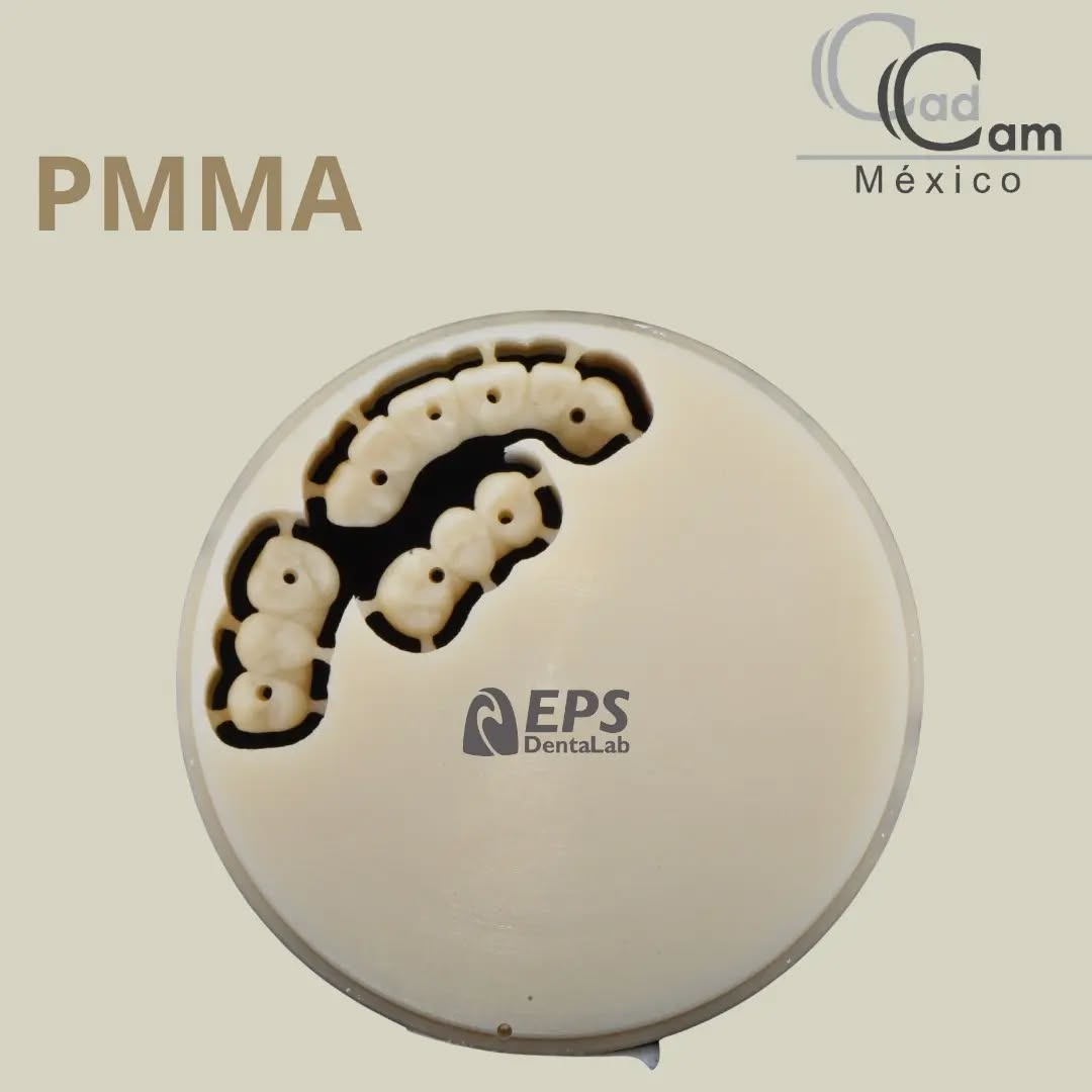 En odontología, el PMMA (Polimetilmetacrilato) se emplea en la fabricación de prótesis dentales removibles, cómo dentaduras postizas y puentes dentales temporales. Su aspecto natural junto a la alta biocompatibilidad permiten que la prótesis dental se asemeje al diente natural. Es fácil de trabajar y se adapta a las necesidades específicas de cada paciente. @epslab lo recomienda por su durabilidad y resistencia al desgaste. Cotiza con nosotros en PMMA: Dentaduras Postizas ( Prótesis completa o parcial) , Puentes y más.
- - - Aviso de responsabilidad: Todas las fotos publicadas en esta cuenta de Instagram son propiedad intelectual de Estudio de Porcelana Suizo S.A de C.V. y están protegidas por derechos de autor.pin alvaro obregon 134 cuernavaca #CadCam #Mexico #Cromocobalto #implantologia #implantesdentales #dentistry #dentista