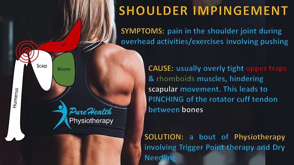 Shoulder pain is usually a matter of faulty biomechanics which can be easily corrected.
Contact us today:
www.purehealthphysio.co.uk
Info@purehealthphysio.co.uk
07443419973
• Feltham
• Sunbury-on-Thames
#physiotherapy #sportsrehab #sportsmassage #dryneedling #acupuncture #sunburyonthames #feltham