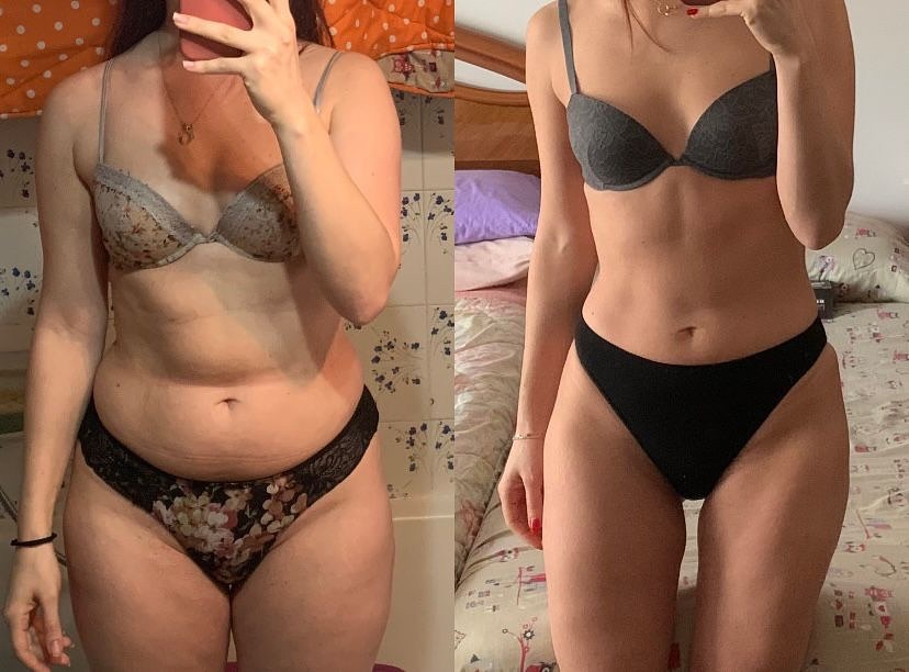 Risultati davvero incredibili: in circa 7 mesi siamo passati dalla foto di sinistra a quella di destra…
A livello visivo non serve dire nulla, parliamo di due fisici completamente differenti.
Massa grassa ridotta drasticamente, infiammazione diminuita nettamente, ritenzione idrica praticamente scomparsa e tutti i parametri relativi allo stato di salute generale migliorati.
Tutto questo senza soffrire la fame e senza alcuna rinuncia.
Ma, soprattutto, ora ha una maggiore conoscenza del proprio corpo e del bellissimo mondo dell’alimentazione.
Ricordate: la dieta non è privazione, ma consapevolezza.
Chapeau @giusy_sabino 😊👨🏻⚕️💪🏼
Qualora fosse di tuo interesse, ti invito a seguirmi, cercarmi su MioDottore, controllare il mio sito www.lucazucchelli.com e a scrivermi per qualsiasi dubbio o chiarimento.
Vorresti trasformarti nella migliore versione di te stesso, ma non sai da dove iniziare? Scrivimi e discutiamone insieme!
Hai già deciso di prenderti cura della tua salute e di rimetterti in forma, ma non sai a quale professionista rivolgerti?
Beh, sono qui per questo! Non tergiversare, contattami!😉
#nutrizione #alimentazionesana #nutrizionista #mangiare #dieta #salute #dimagrire #cibosano #fitness #fit #sport #healthyfood #health #lifestyle #fat #body #bodybuilding #diet #muscoli #muscles #vita #life #forza #atleta #athlete #palestra #gym #endurance #allenamento #performance