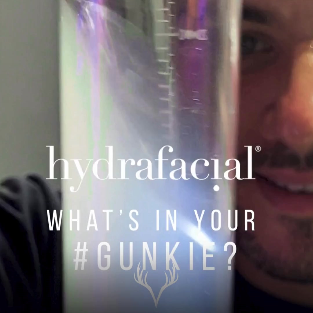 ✨ Hydrafacial-Junkie – und du? ✨
Ganz ehrlich: zu welchem Team gehörst du? 👀👇
🖤 Team „ZEIG HER!“
Unbedingt sehen, was wir aus deiner Haut geholt haben.
Poren-Content = Therapie. 😌
🤍 Team „NEIN DANKE!“
Bitte weg damit, ich will nur den Glow –
alles andere überfordert mich. 🙈
Beides ist völlig okay.
Wichtig ist nur eins: Deine Haut ist danach sauber, ausgeglichen und happy. ✨
💡 Fun Fact:
Was da rauskommt, sind meist Sebumfilamente – völlig normal, kein Grund zum Gruseln.
Also…
👉 Team Gunk-Analyse oder Team Augen zu & Glow? 😄
📞 Termine bitte telefonisch oder über unser Online-Buchungstool
📍 Beauty Bar Baden
#hydrafacial #hydrafacıal #hydrafacial💦 #hydrafacialglow #hydrafacialdeluxe #hydrafacialgunkie #hydrafacialgunkies