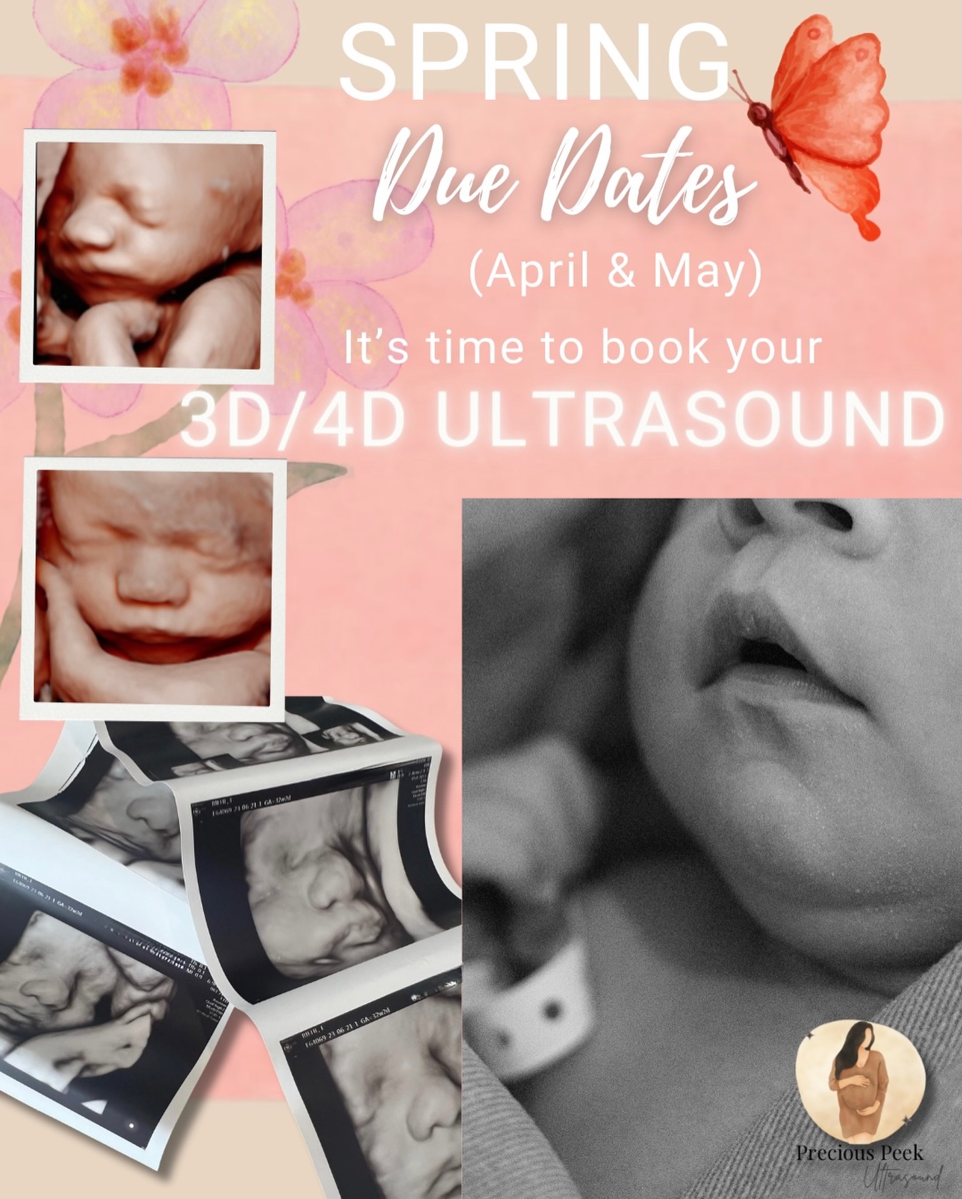 April & May due dates — it’s officially your moment ✨
Now is the perfect time to book your 3D/4D/5D ultrasound.
Best captured between 27–35 weeks for the clearest, cutest facial details 🤍
Evening and weekends tend to book first —
Reserve your session online; preciouspeek5d.com