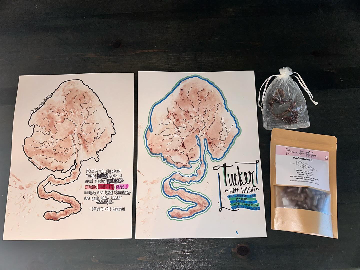 I’ve spoken a lot about placentas on this page and all the things that can be done with them. I chose to encapsulate mine and I’m so happy I did! The benefits it’s had on my mental health are absolutely incredible. The days where I would have baby blues or crippling anxiety, my placenta pills helped immensely. @alexlittleee I am so grateful to you and the work you do! Not only did she make the process so easy and smooth but also gave me these beautiful prints! Highly recommend to anyone wanting their placenta encapsulated by the best!! 🌳 ❤️