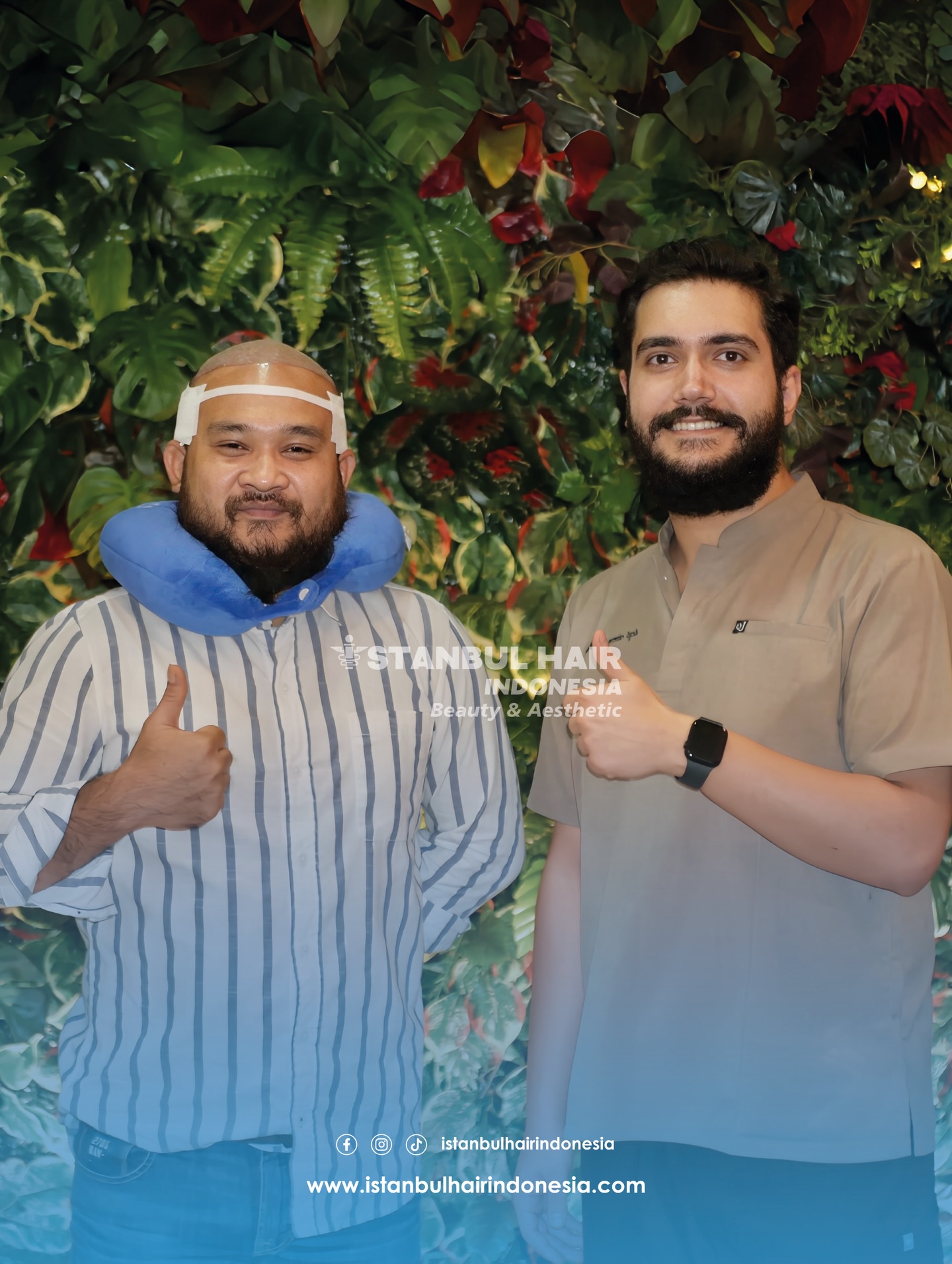 5.200 grafts, bukan sekadar angka — tapi bukti komitmen kami untuk hasil maksimal tanpa kompromi 💪
Setiap graft ditanam dengan presisi, tanpa manipulasi, tanpa “hitungan semu”.
Dari Kalimantan, menuju kepercayaan diri yang benar-benar baru ✨
5,200 grafts — not just a number, but a true reflection of our commitment to honest, high-quality results 💪
Every single graft is implanted with care — no tricks, no inflated numbers.
From Kalimantan, to a renewed confidence ✨
#IstanbulHairIndonesia #HairTransplant #5200Grafts #RealResults #NoFakeCount