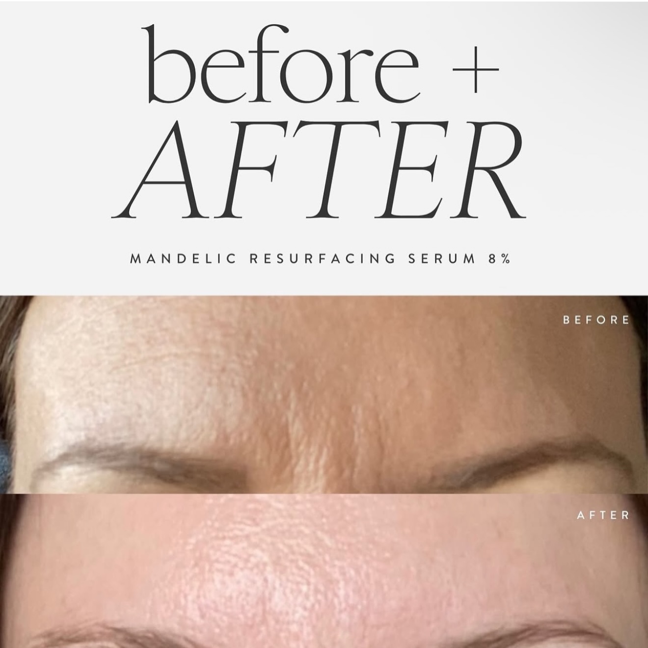 Everyone struggles with skin problems, whether that be dullness, fine lines, or acne breakouts. That’s why greenenvee produces all natural and results-driven products to treat every skin concern.