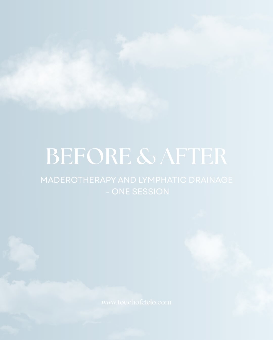 Before & after just ONE session ✨
By combining Maderotherapy + Lymphatic Drainage, we work on sculpting while helping the body release excess fluid and toxins.
• Less bloating
• More definition
• Lighter, smoother feeling
• Improved circulation
This is why results can be visible from the very first session, and they continue to improve with consistency.
Always with care,
Touch of Cielo🩵
www.touchofcielo.com
#resultsmaderotherapy #lymphaticdrainage #fyp #mobilemassagetherapist