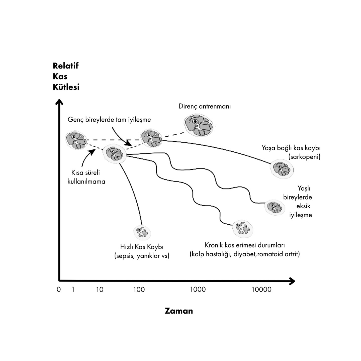Kas kaybının sebebi, genellikle hareketsizlik, yetersiz beslenme, yaşlanma veya hastalıklar nedeniyle kas dokusunun azalmasıdır.
Bu da sağlık ve yaşam kalitesi üzerinde büyük bir etkiye sahip.
Yaşlanma ve çeşitli hastalık durumları kas kaybını şu sebeplerden dolayı hızlandırabilir:
- Azalmış fiziksel aktivite
- Anabolik direnç
- Ve katabolik ve pro-inflamatuar durumlar
Yaşlanma, hastalık veya yaralanmalarla birlikte hızlanan kas kaybına karşı korunmak için hem direnç egzersizleri hem de yeterli beslenme kritik öneme sahiptir.