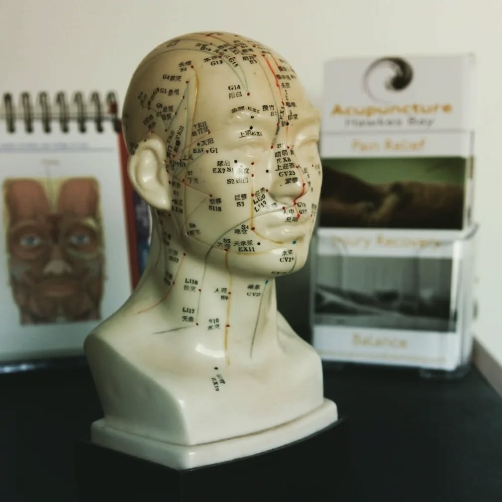 Lately in the clinic I have been treating TMJ issues, sinusitis, nausea and balance issues.
Love how tcm is so versatile.
#acupuncturehawkesbay #acupuncturenz #acupuncture