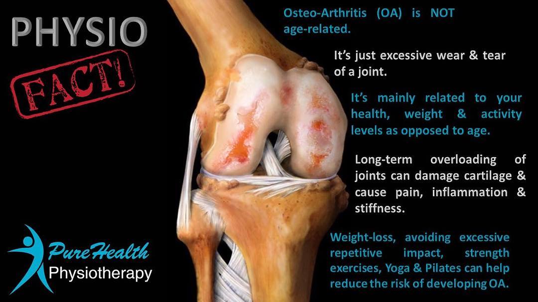 Physio Fact
#physiotherapy #sportsrehab #dryneedling #sportsmassage #feltham #sunbury