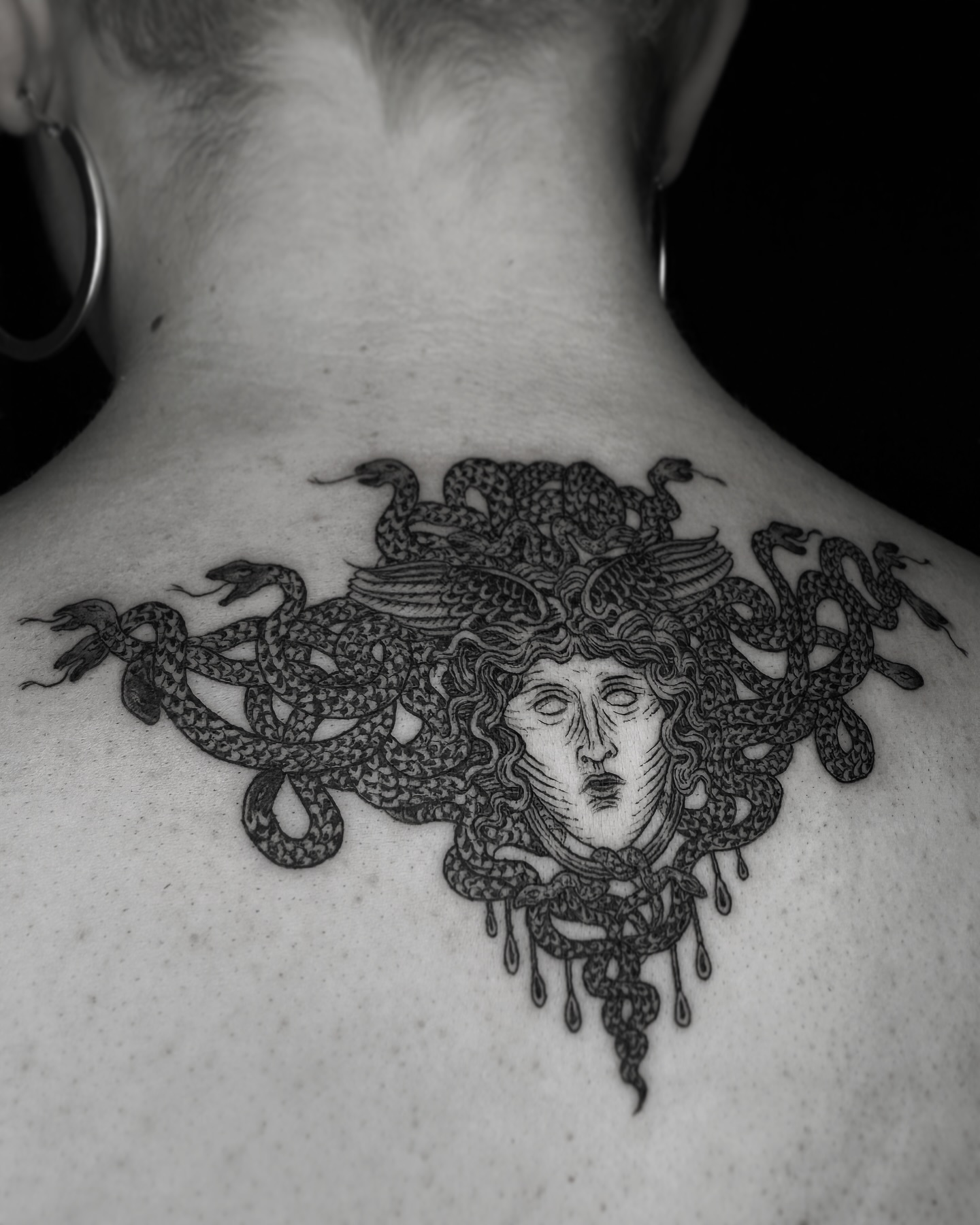 • MEDUSA •