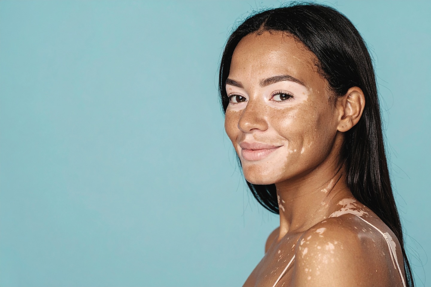 La pelle è un linguaggio sottile che riflette il nostro benessere.
Per questo le macchie non vanno temute ma comprese.
Ne parliamo nel nostro magazine con la dottoressa @pucciromano
.
Se vuoi approfondire questa tematica in particolare, ma anche argomenti come Skincare, aging e cura della pelle scarica il nostro magazine dal sito www.goodliving.it
.
#skincare #aging #macchie #dermocosmesi #naturalskincare