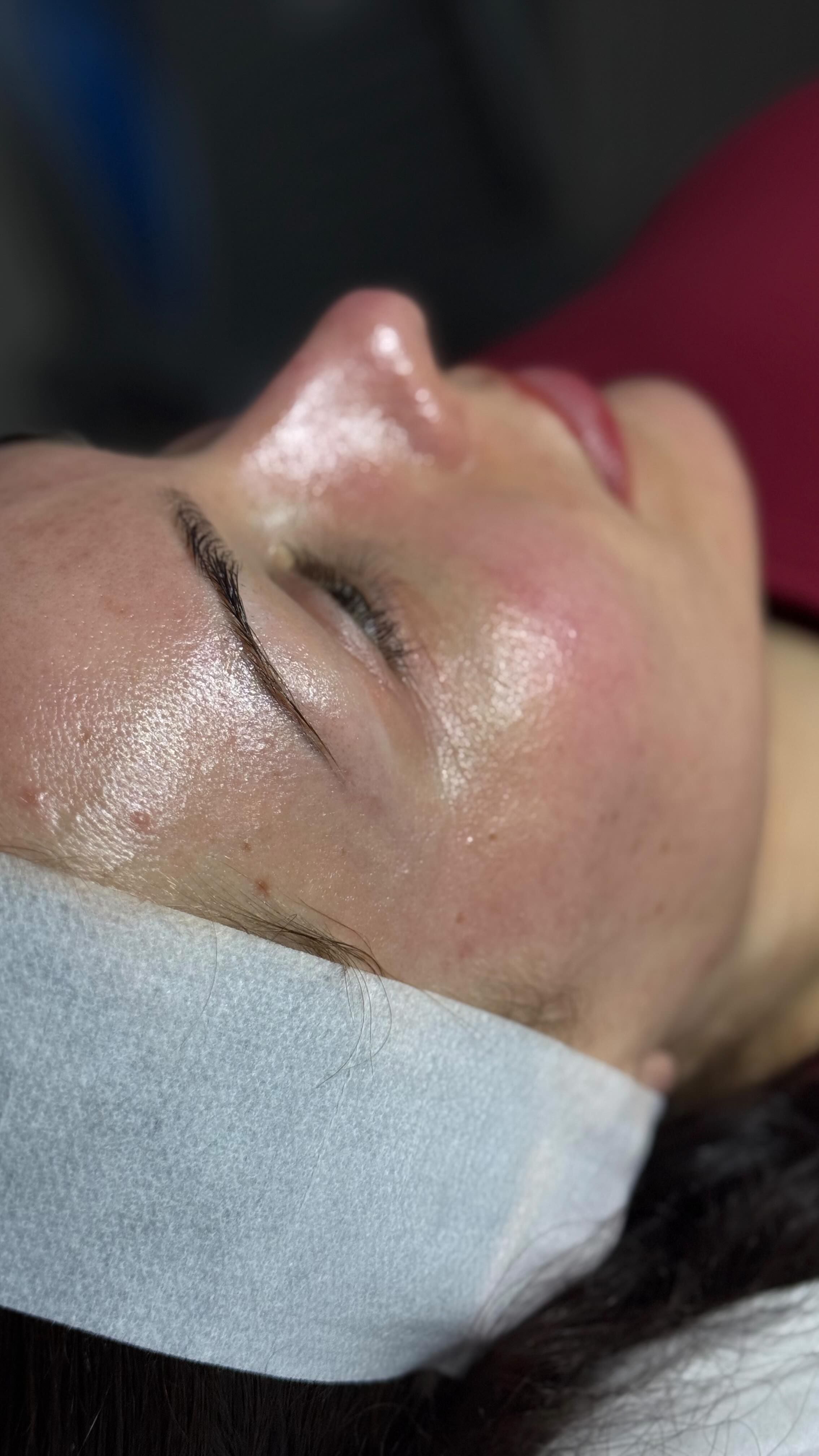 Free microneedling consultations, DM to book & see how this treatment can help your skin type.
#cheltenham #gloucestershire #skincare #salon #bathroadcheltenham