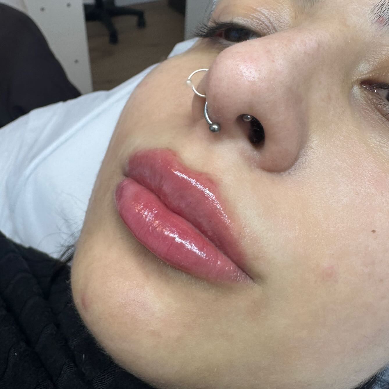Komplexe Lippen 👄
Nicht jede Lippe ist „einfach“.
Asymmetrien, alte Filler oder schwierige Formen brauchen Erfahrung und Feingefühl 💉✨
Jede Korrektur ist individuell – mit dem Ziel, Harmonie und Natürlichkeit zurückzubringen.
#Lippenkorrektur #KomplexeLippen #NatürlicheÄsthetik #AestheticMedicine #deincosmetologist
