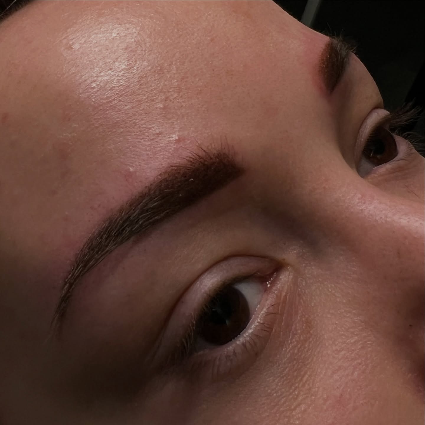 „Das geht weg. Komm in vier Wochen wieder.“
Diese liebe Kundin hat sich ihre Augenbrauen woanders pigmentieren lassen.
Sie hat mich einen Tag nach ihrer Augenbrauen-Pigmentierung hier bei Insta angeschrieben.
Verzweifelt.
Weil sie sofort gesehen hat: Das passt nicht.
Ungleichmäßig. Unruhig. Einfach kein gutes Gefühl.
Die Antwort, die sie vorher bekommen hat?
„Das geht weg. Warte vier Wochen.“
Und nein.
Das ging nicht weg.
Und das wusste sie auch.
Sie hat mir direkt bei Instagram geschrieben, weil sie jemanden gesucht hat, der ehrlich hinschaut. Das Vertrauen in das andere Studio war verständlicherweise gestört.
Ich habe mir die Brauen genau angesehen
und am nächsten Tag gezielt mit Remover gearbeitet.
Nur dort, wo es nötig war.
Vier Wochen später noch einmal.
Ruhig. Sauber. Mit Plan.
Erst Monate später haben wir neu pigmentiert, um das auszugleichen, was vorher einfach nicht stimmig war.
Fehler können passieren.
Wirklich. Auch Profis sind nicht perfekt.
‼️Aber was für mich nicht geht:
jemanden damit allein zu lassen.
So zu tun, als wäre Zeit die Lösung für alles.
Viele lehnen Fremdarbeiten ab.
Verständlich. Sie sind anspruchsvoll.
Ich schaue trotzdem hin.
Und sage ehrlich, was möglich ist und was nicht.
SHÆDE ist kein Ort für schnelle Antworten.
Sondern für Menschen, die ernst genommen werden wollen – gerade dann, wenn sie unsicher sind.
Das Ergebnis heilt jetzt ab.
Und wir schauen weiter gemeinsam drauf.
So, wie es sein sollte.
Wie würdest du reagieren, wenn man dich mit einem ‚Warte vier Wochen‘ nach Hause schickt? ⬇️
#shæde #potsdam #powderbrow